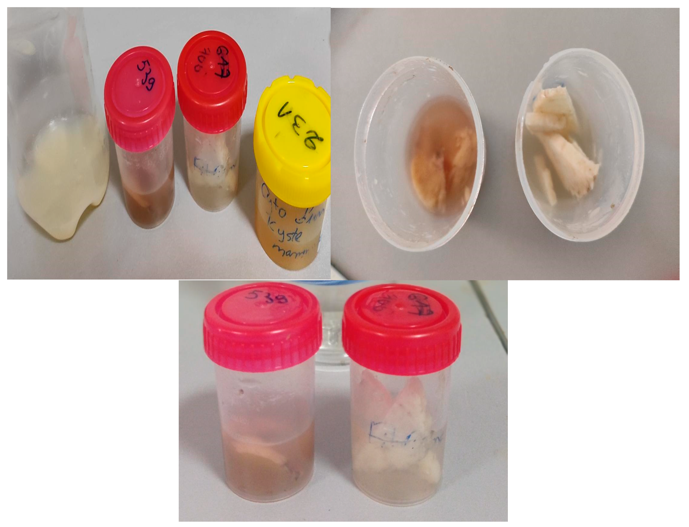 Micromachines 14 02114 g016