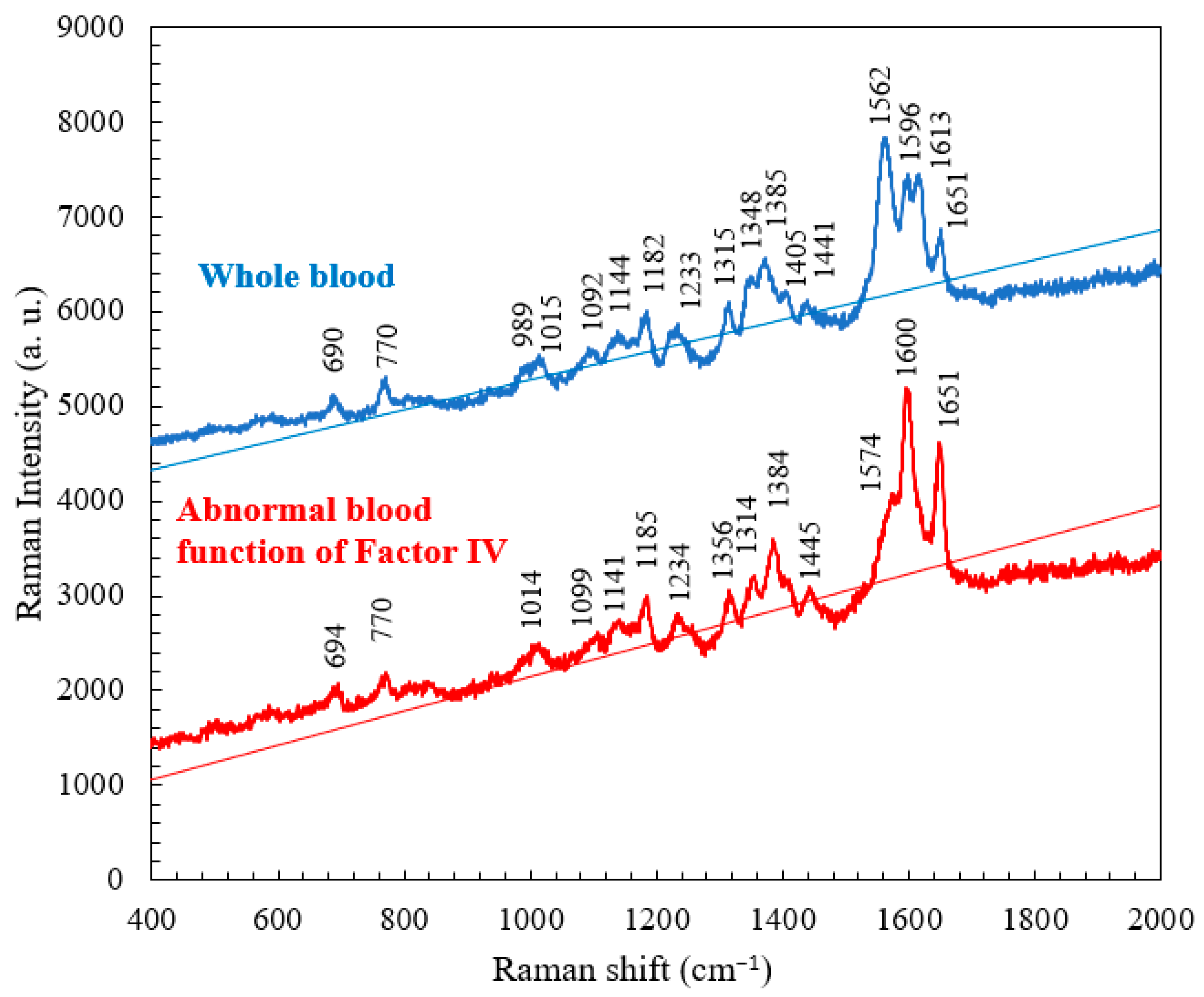 Micromachines 15 00021 g006