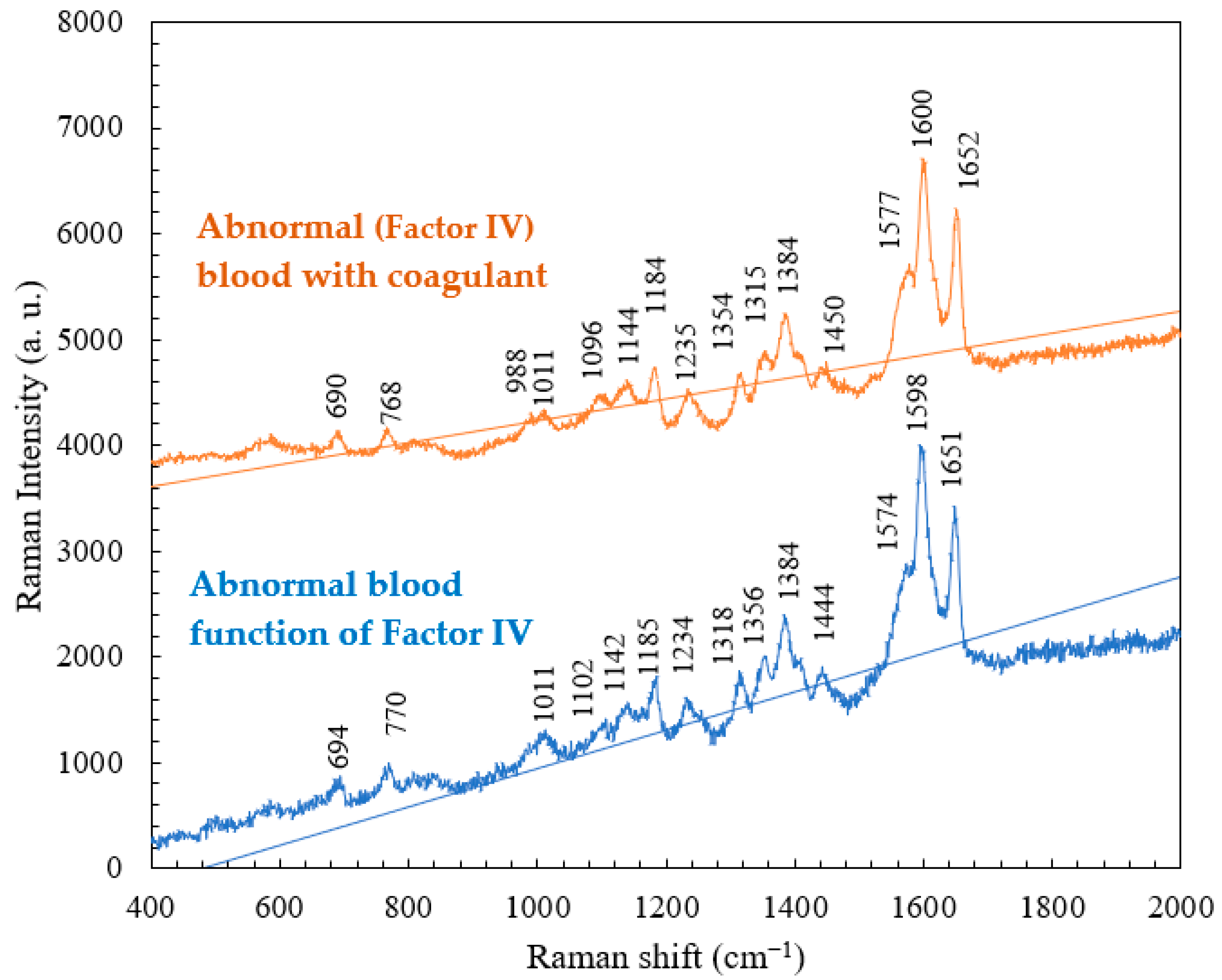 Micromachines 15 00021 g007
