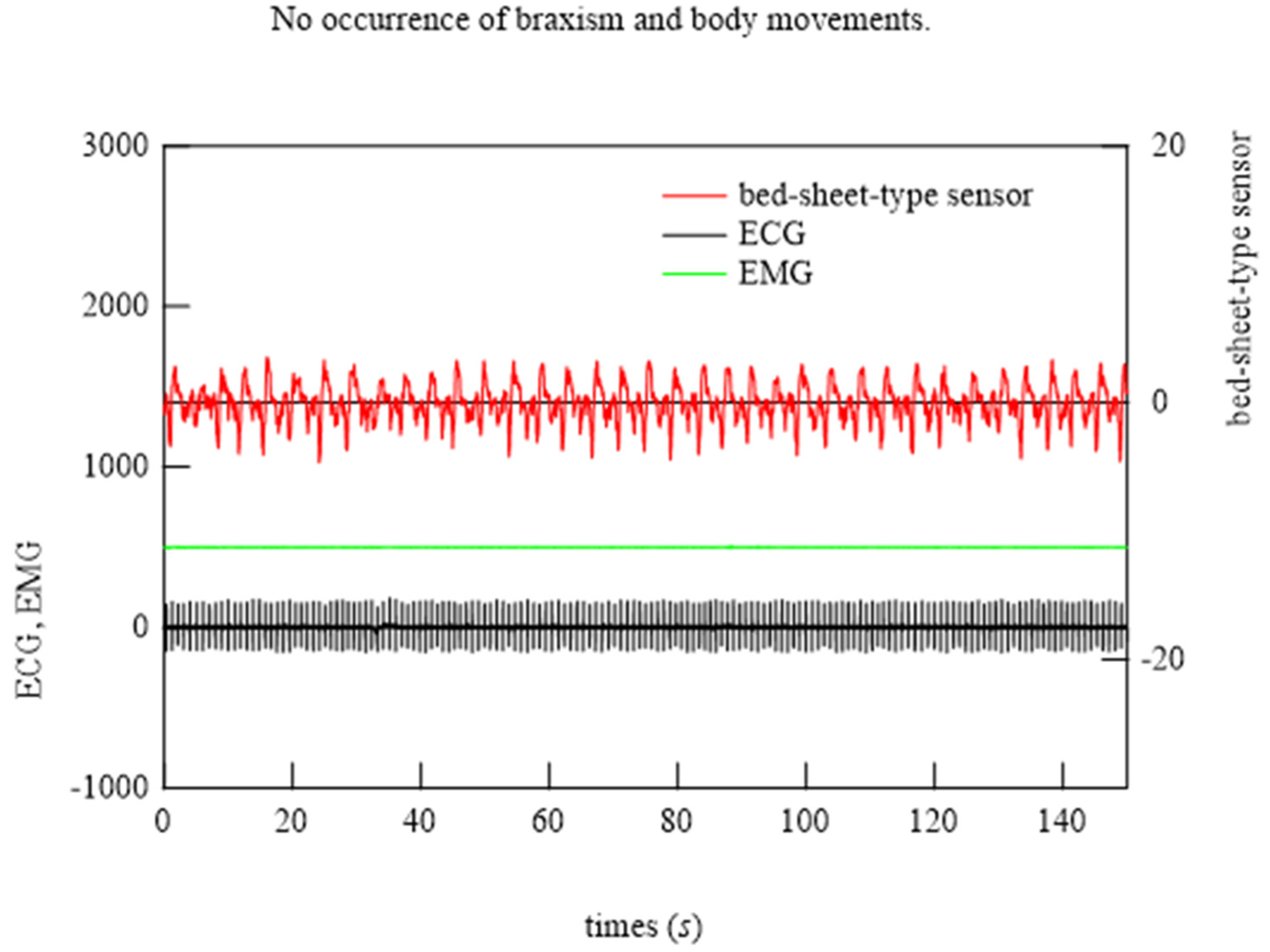 Micromachines 15 00086 g014