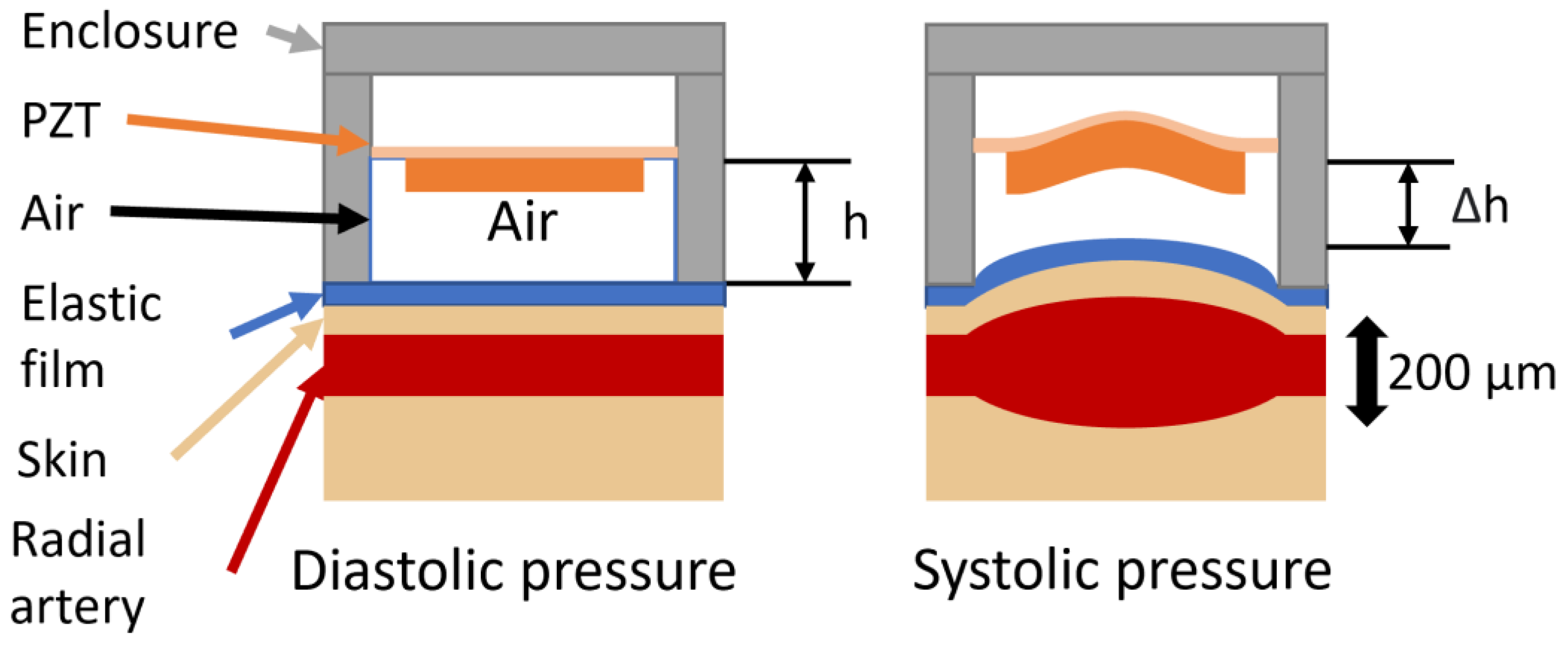 Micromachines 15 00118 g001