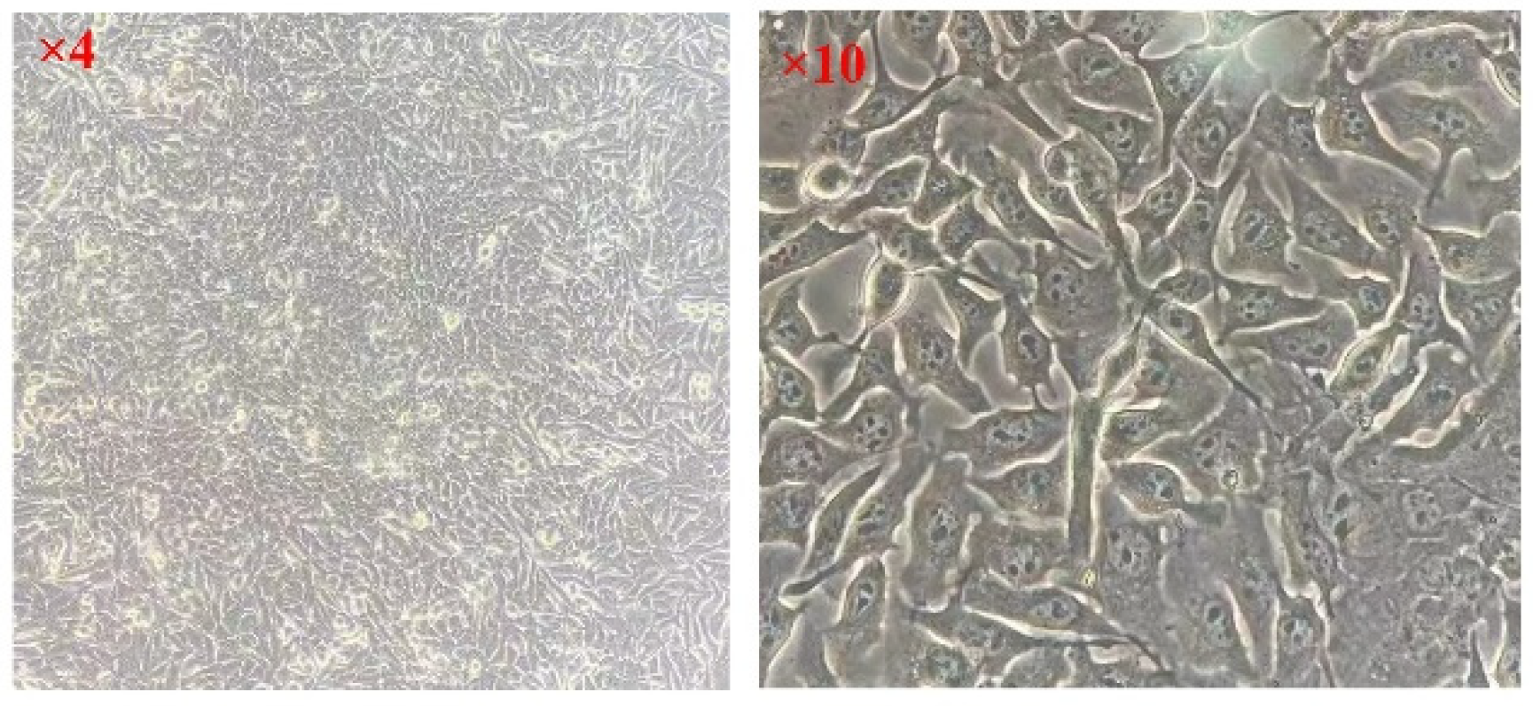 Micromachines 15 00122 g004