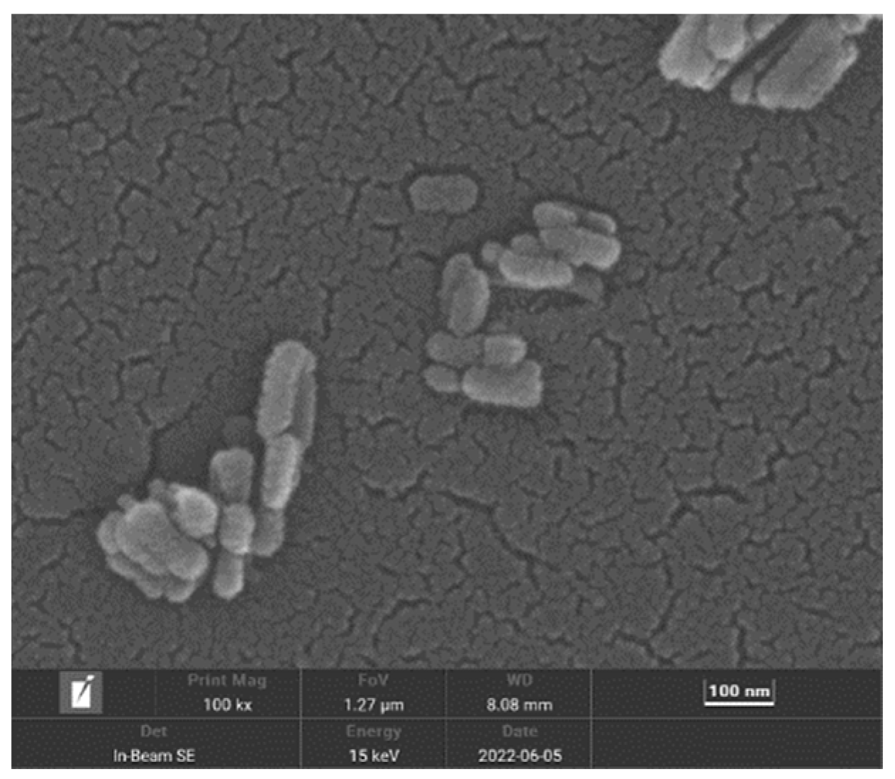 Micromachines 15 00122 g005