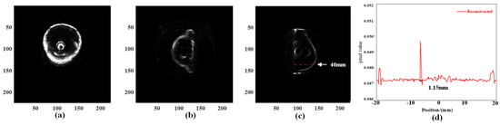 A High-Resolution 3D Ultrasound Imaging System Oriented towards a ...