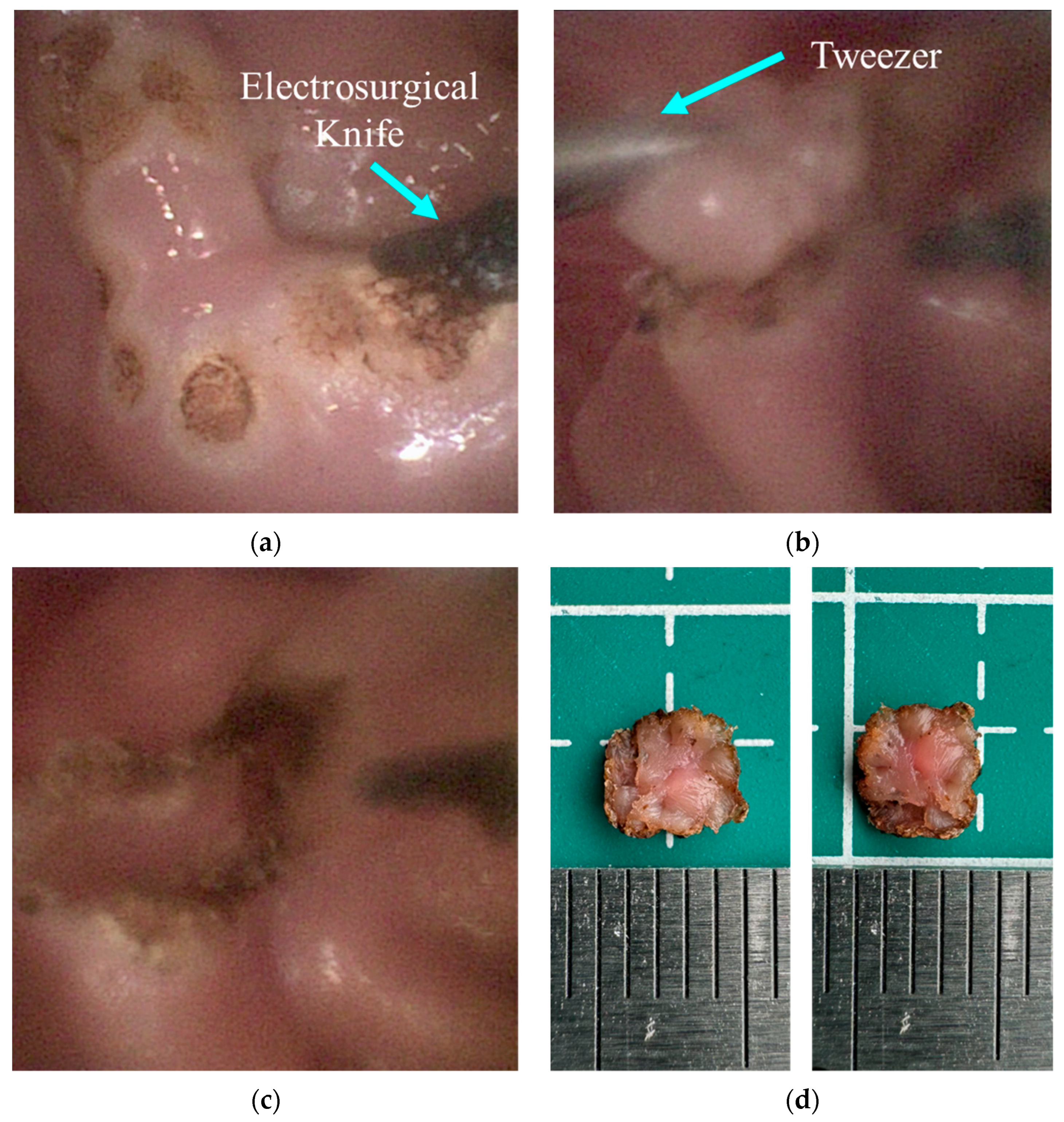 Micromachines 15 00276 g015