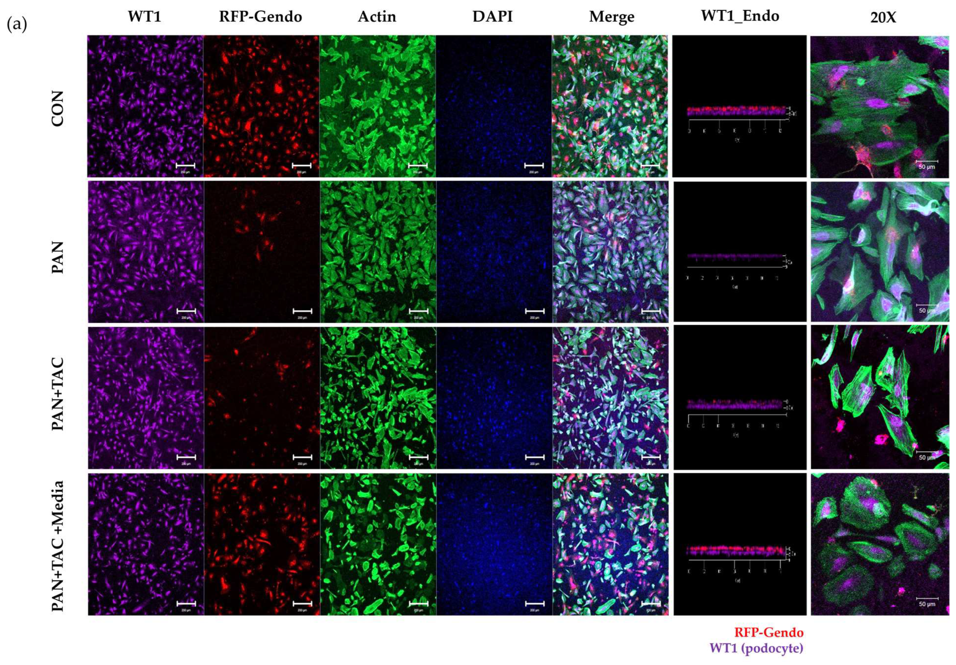 Micromachines 15 00317 g004a