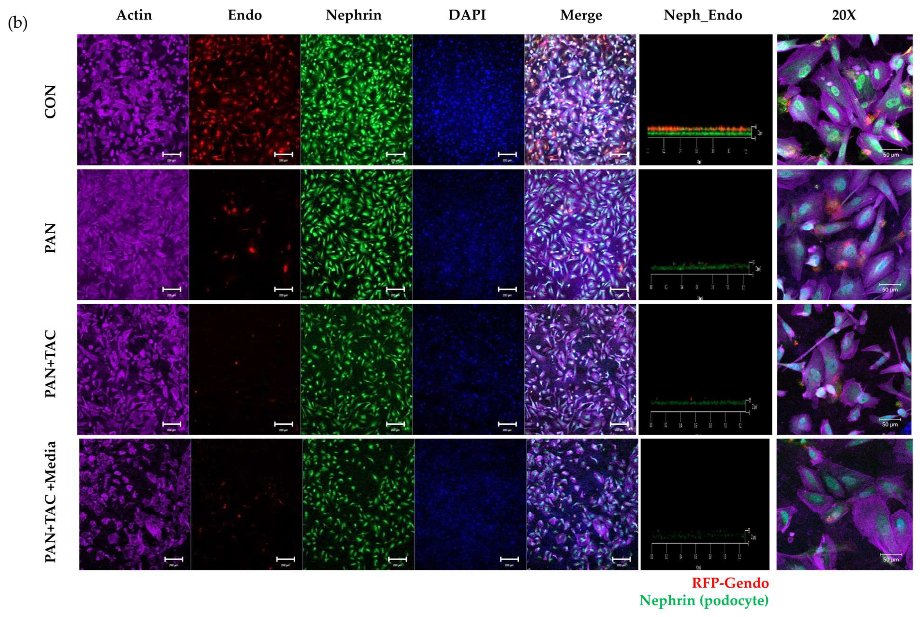Micromachines 15 00317 g004b