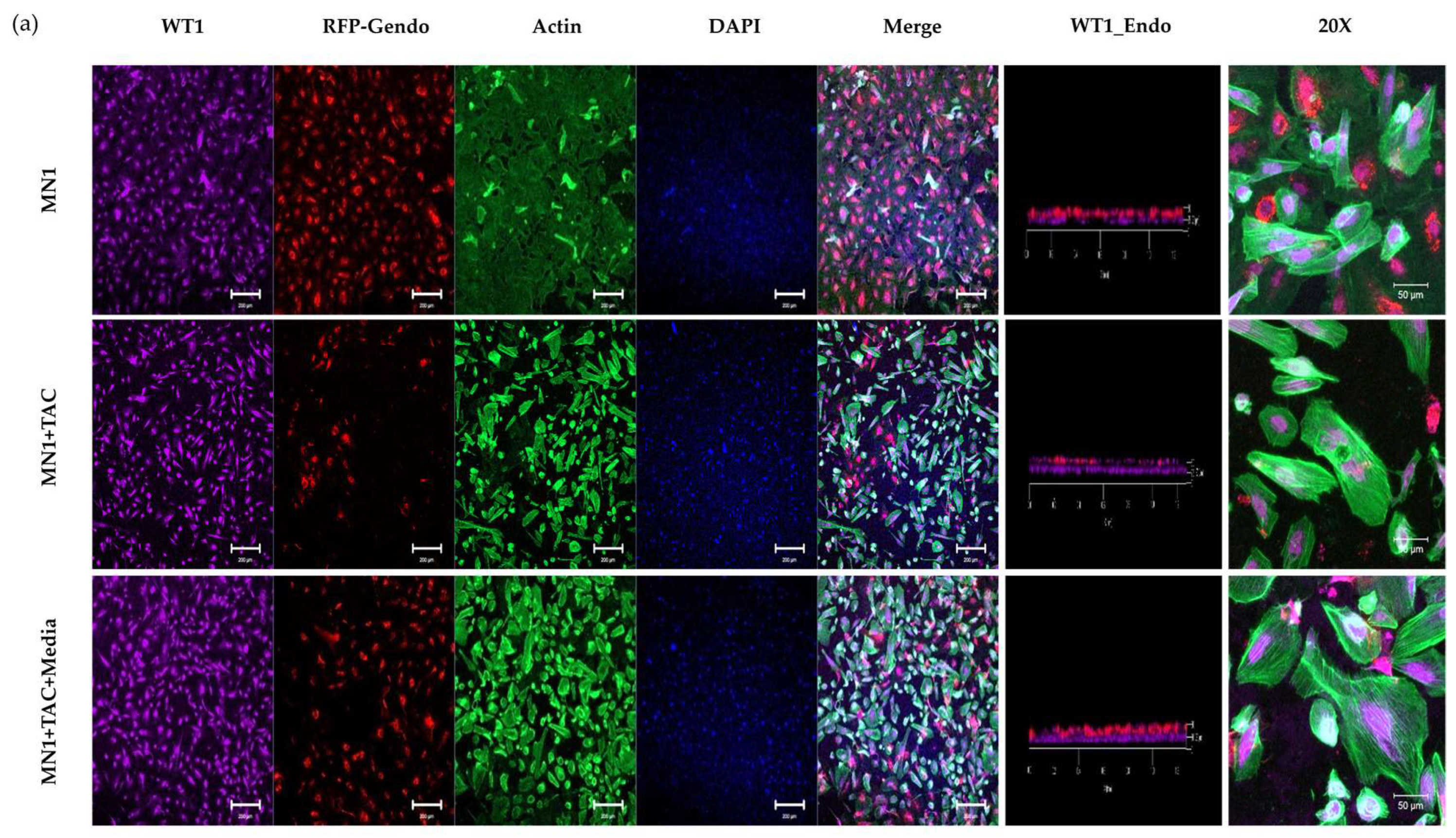 Micromachines 15 00317 g007a