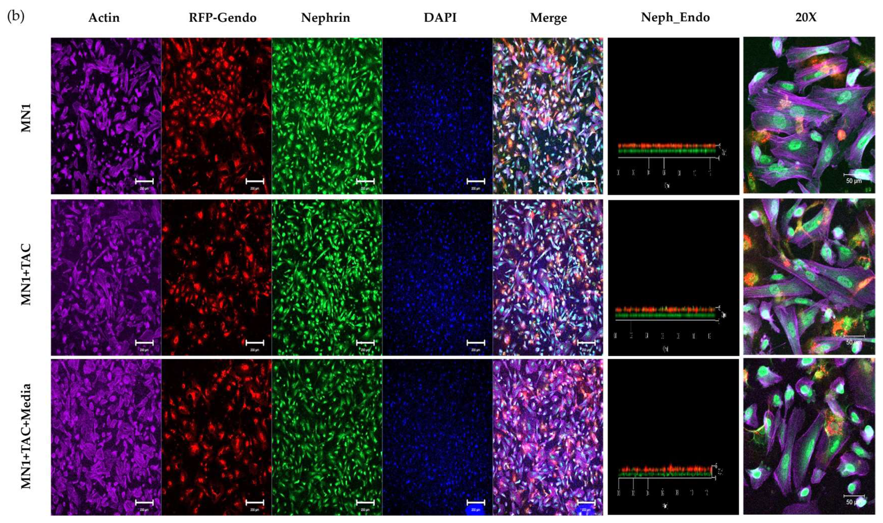 Micromachines 15 00317 g007b