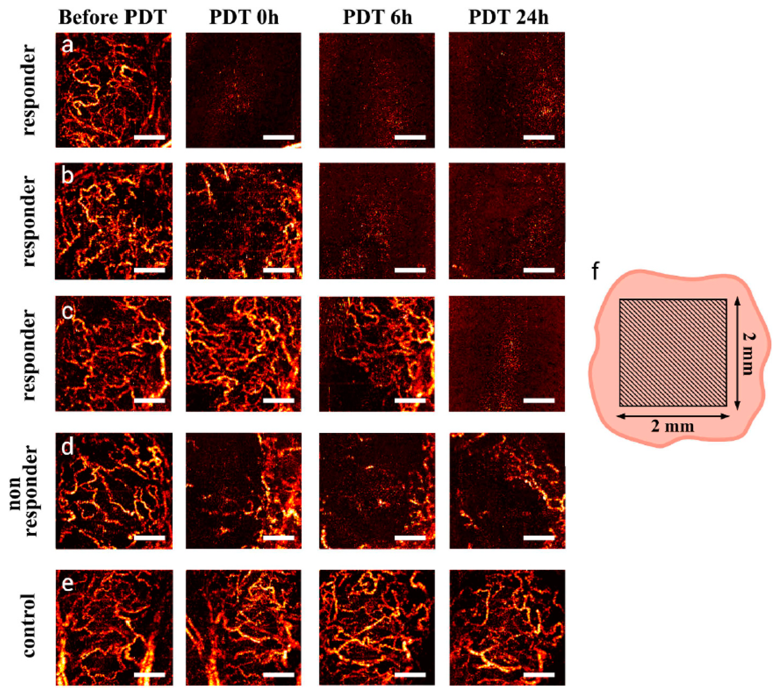 Micromachines 15 00564 g013 Micromachines 15 00564 g013