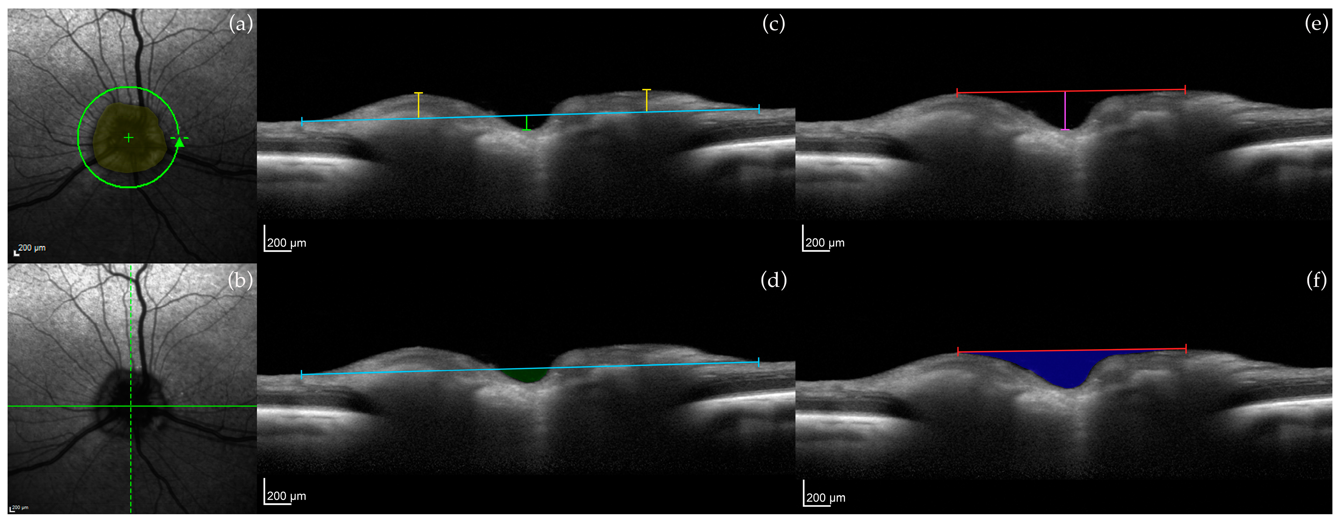 Micromachines 15 00780 g002