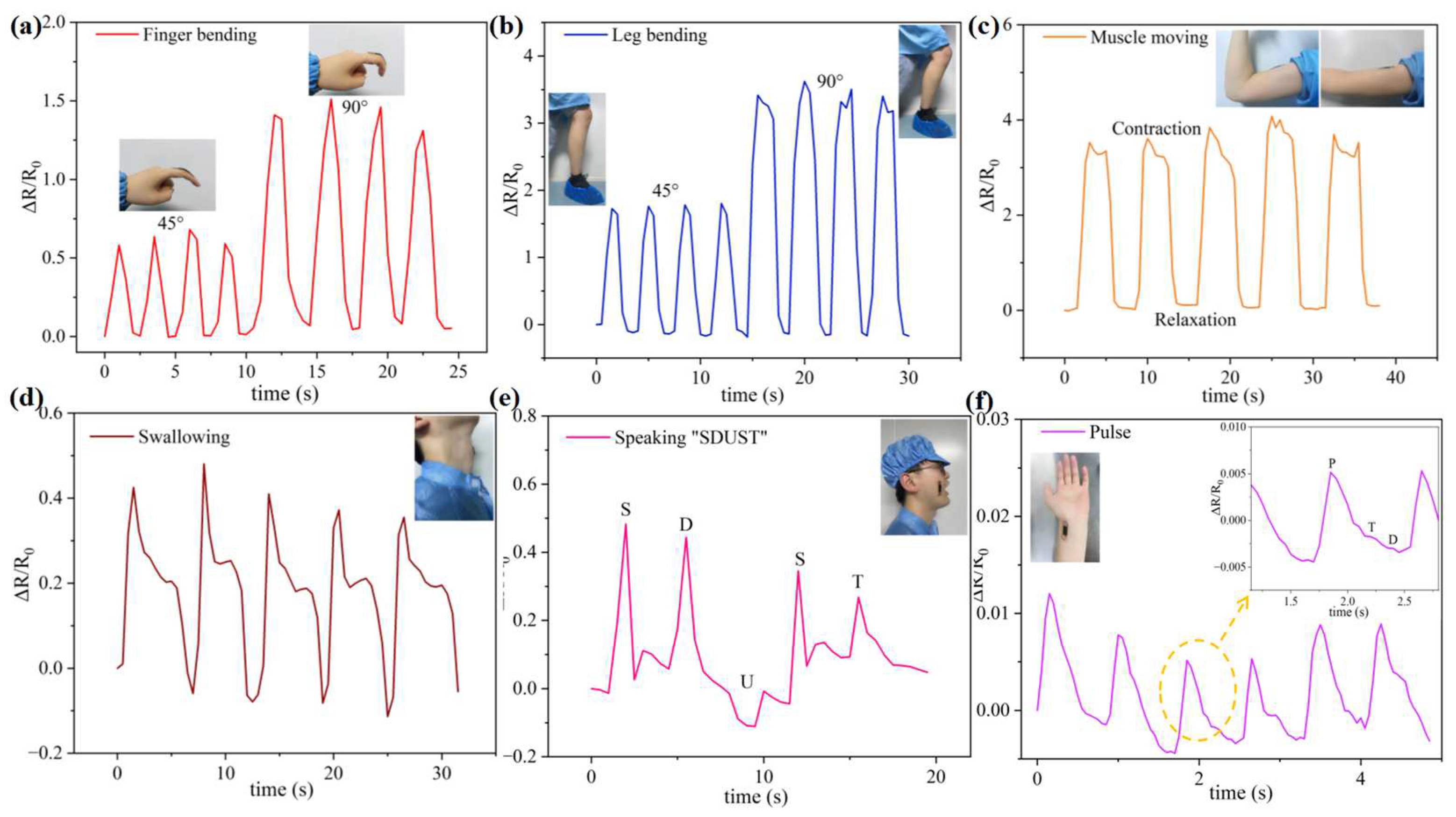 Micromachines 15 01301 g005