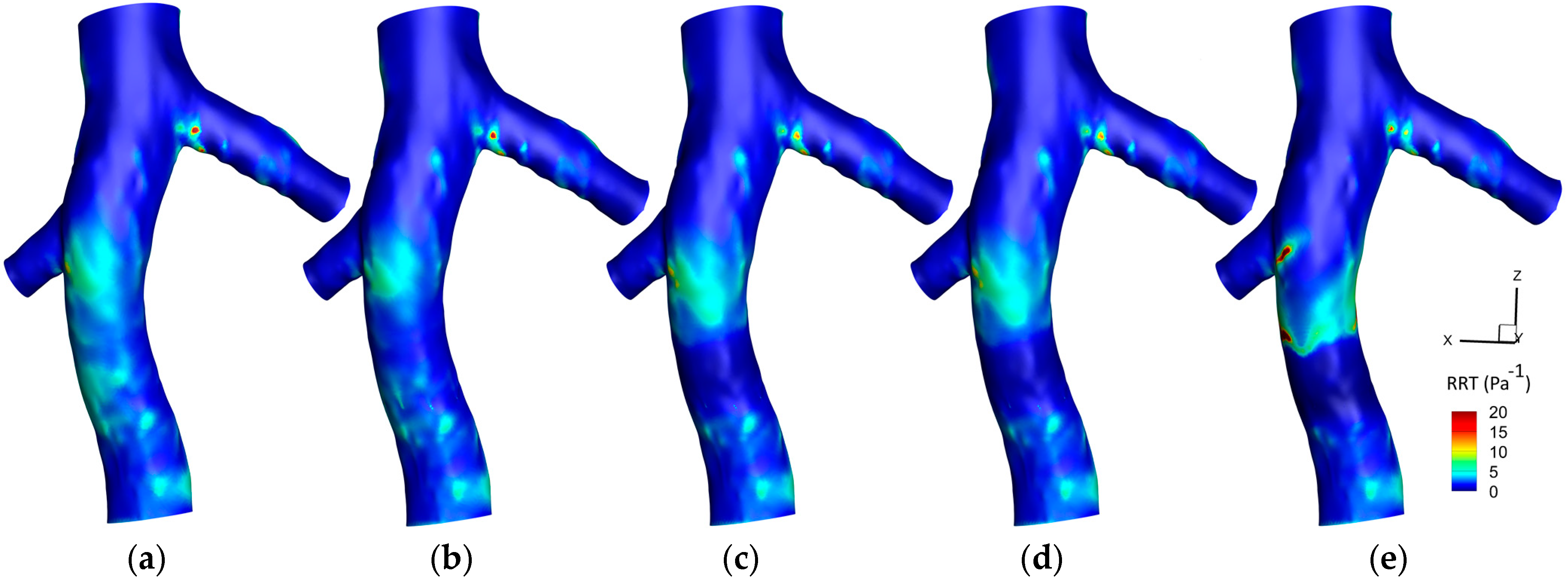 Micromachines 16 00051 g011