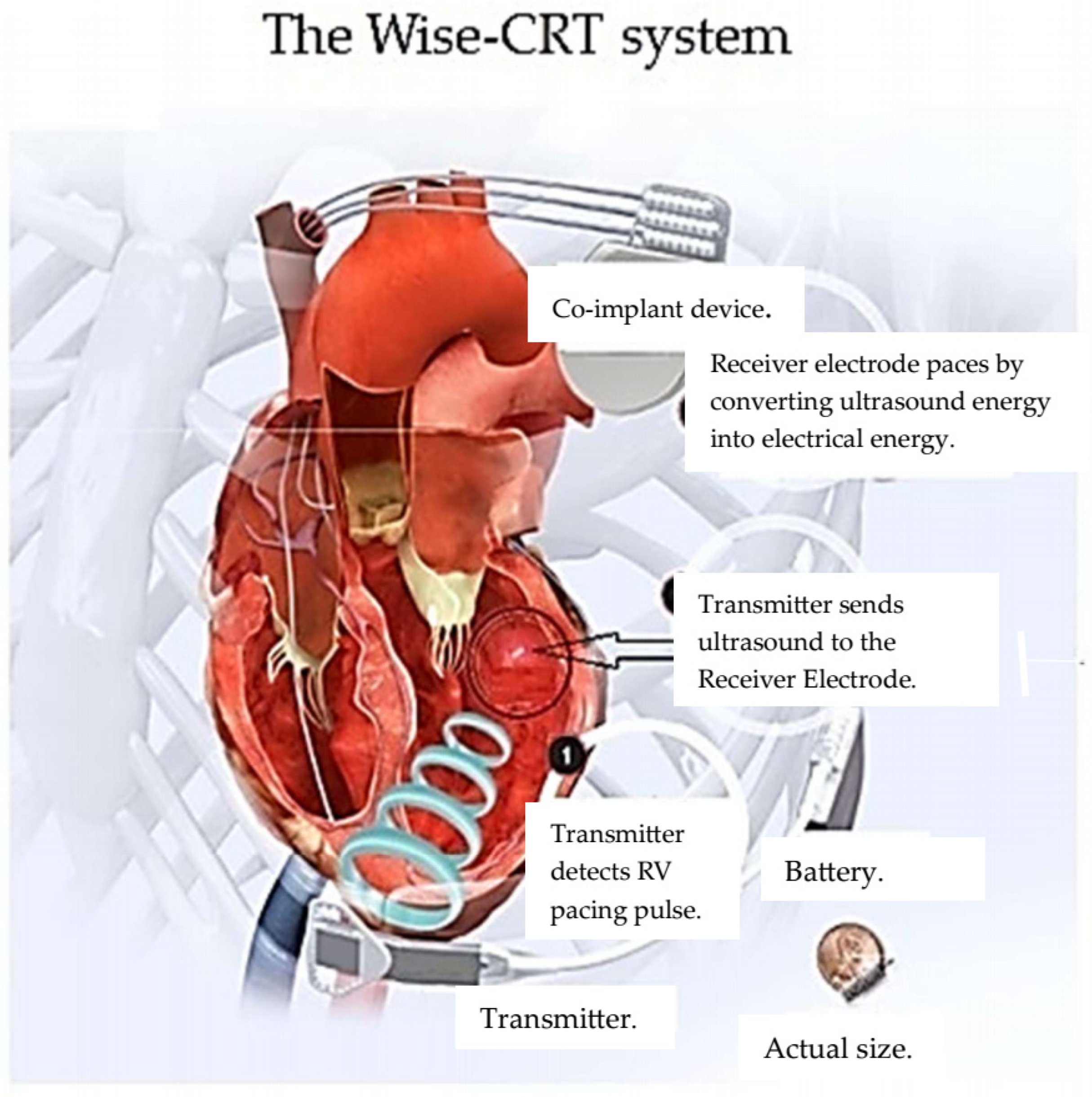 Micromachines 16 00089 g006 Micromachines 16 00089 g006