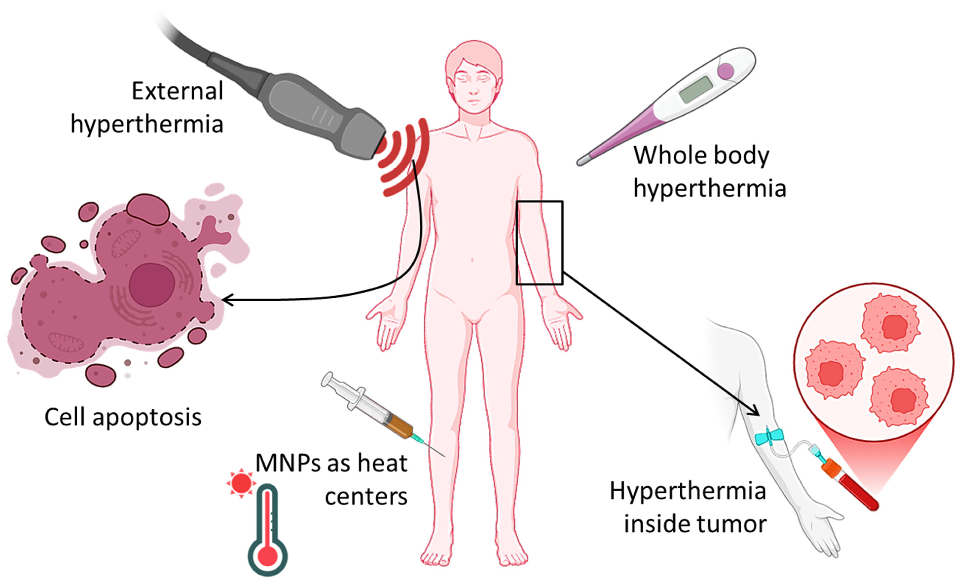 Micromachines 16 00174 g004