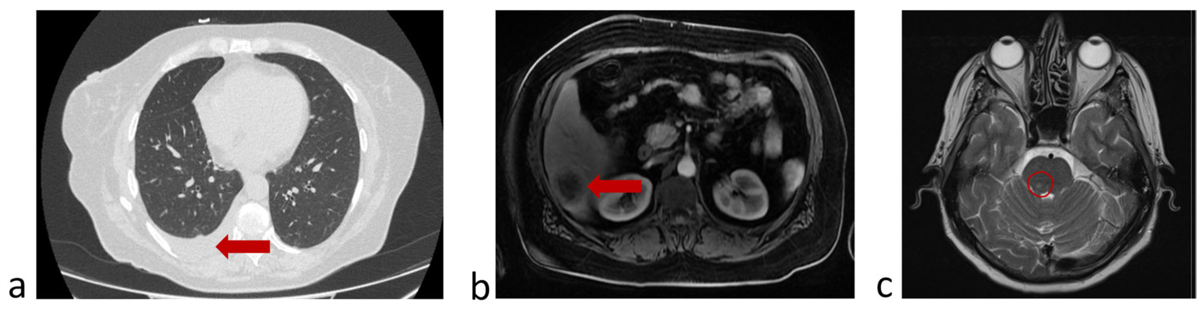Micromachines 16 00470 g008