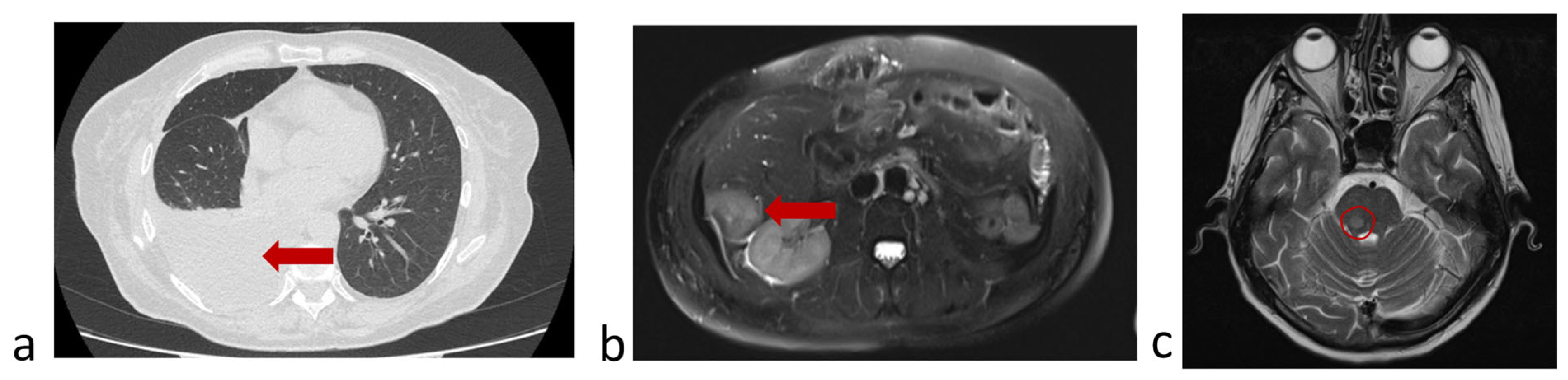 Micromachines 16 00470 g010