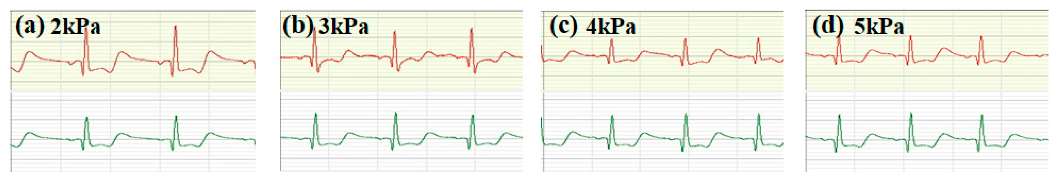 Micromachines 16 00821 g006