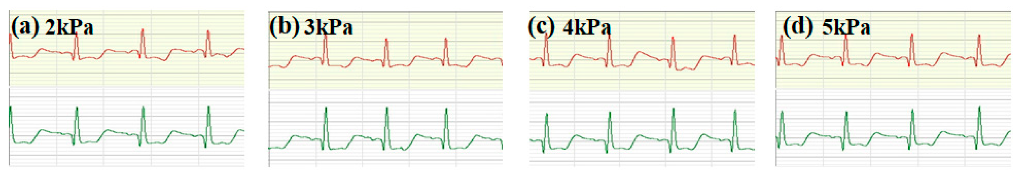 Micromachines 16 00821 g008