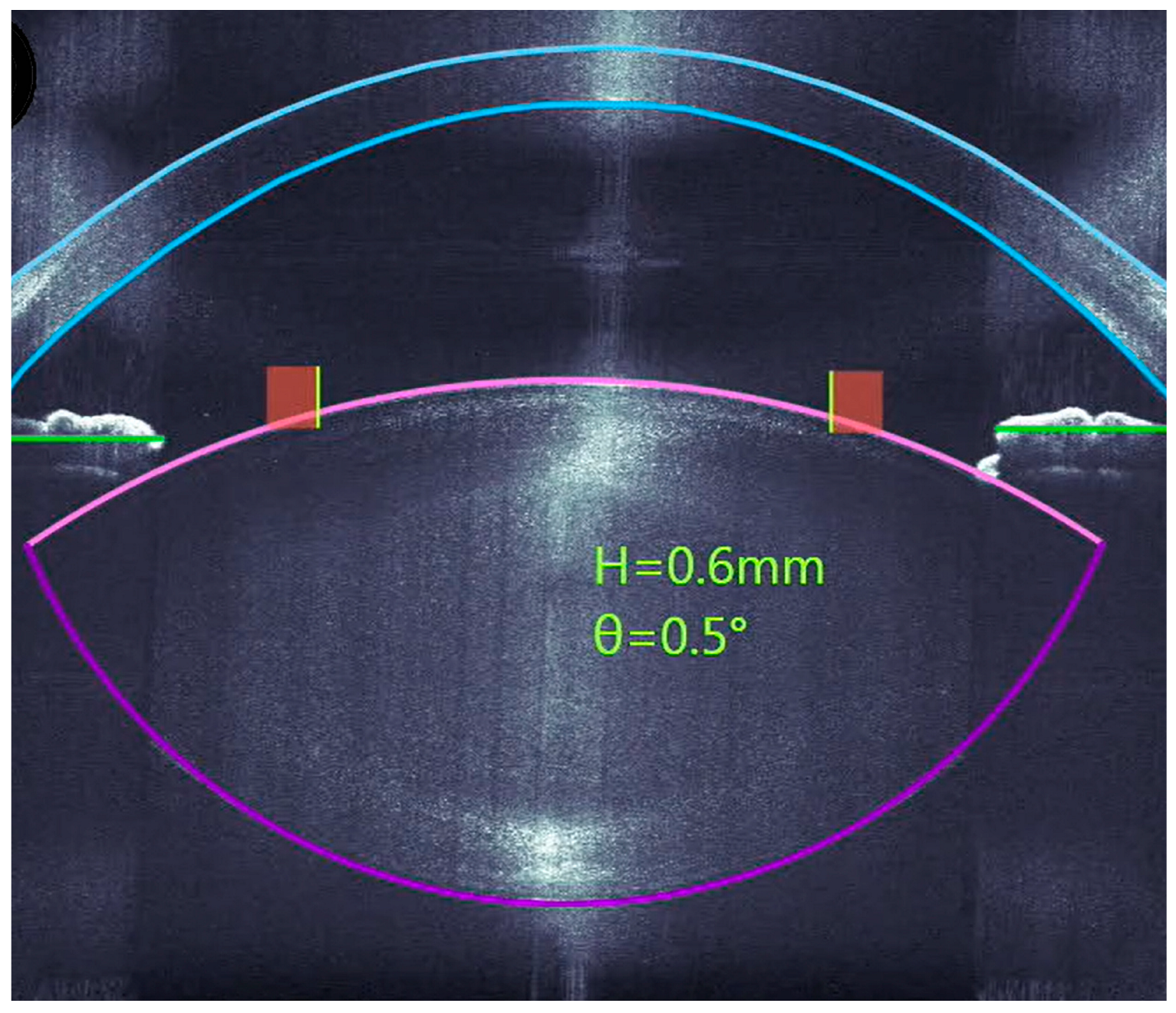 Micromachines 16 00939 g001 Micromachines 16 00939 g001