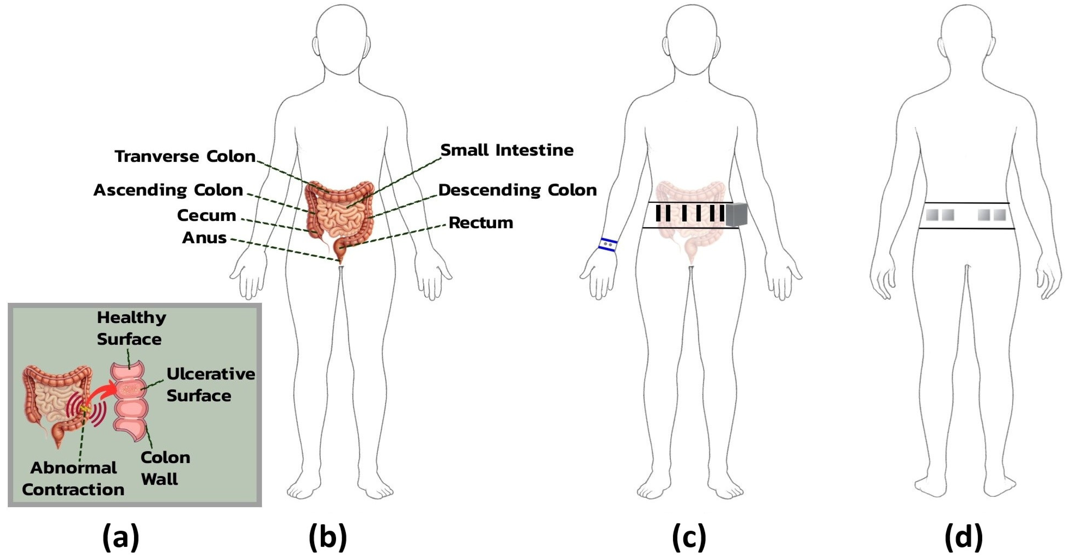 Micromachines 16 01255 g004