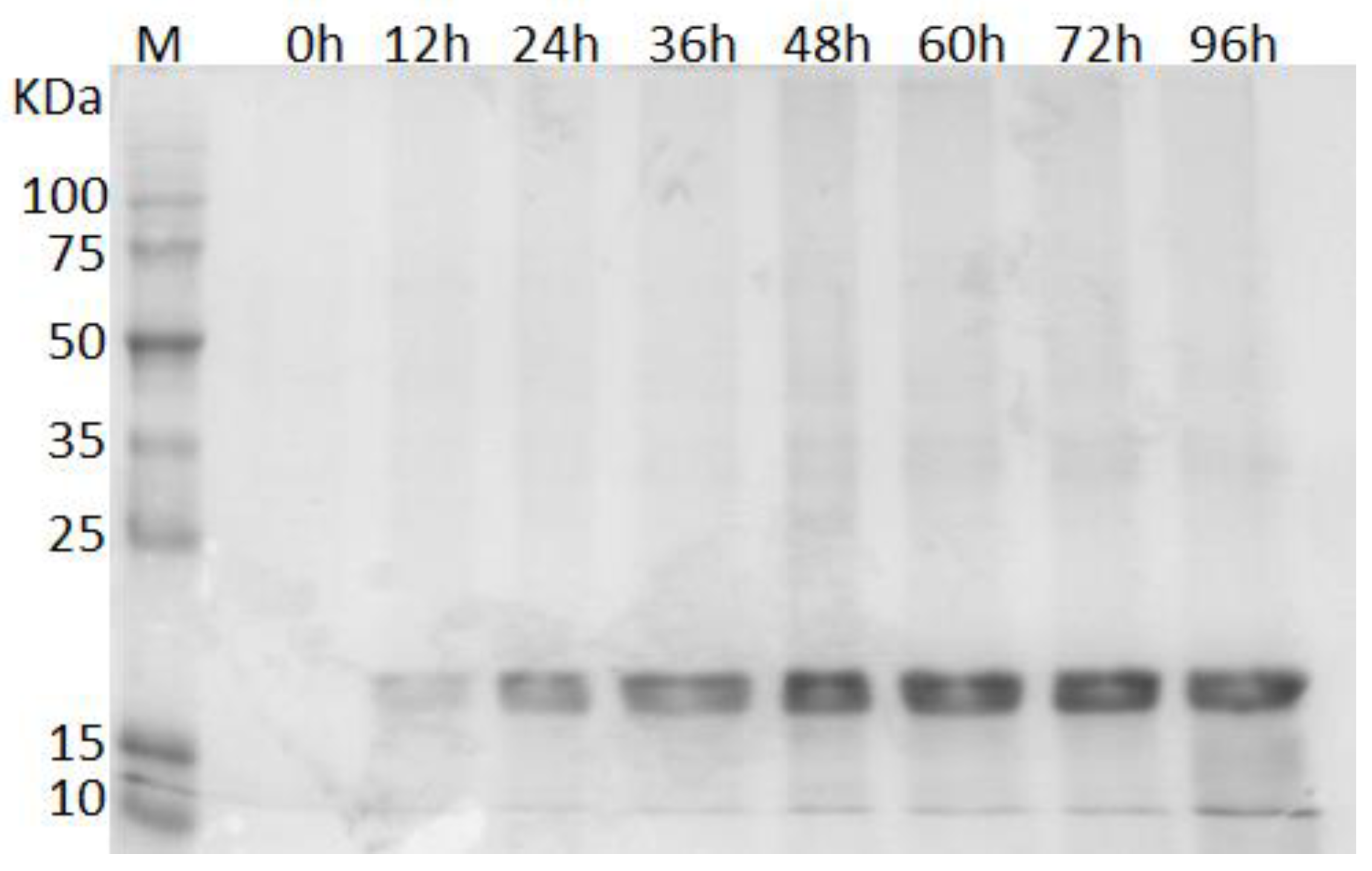 Microorganisms 06 00037 g001 Microorganisms 06 00037 g001