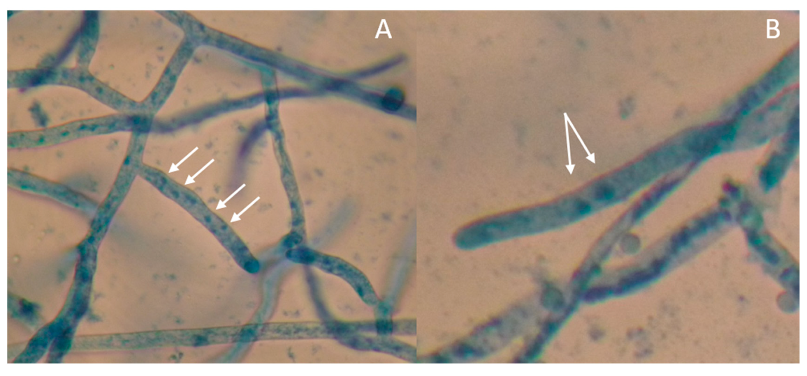 Microorganisms 07 00088 g005