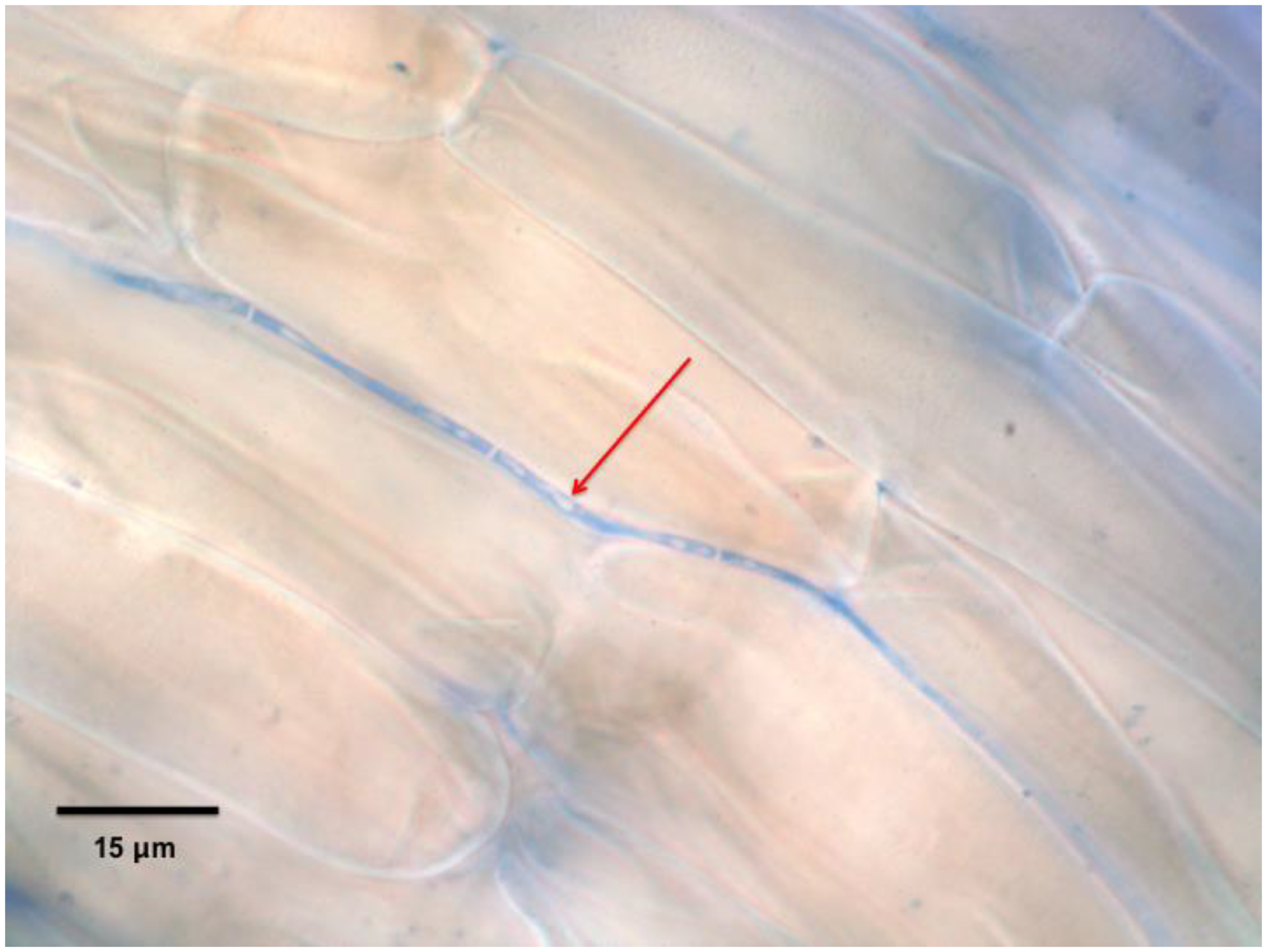 Microorganisms 07 00143 g003