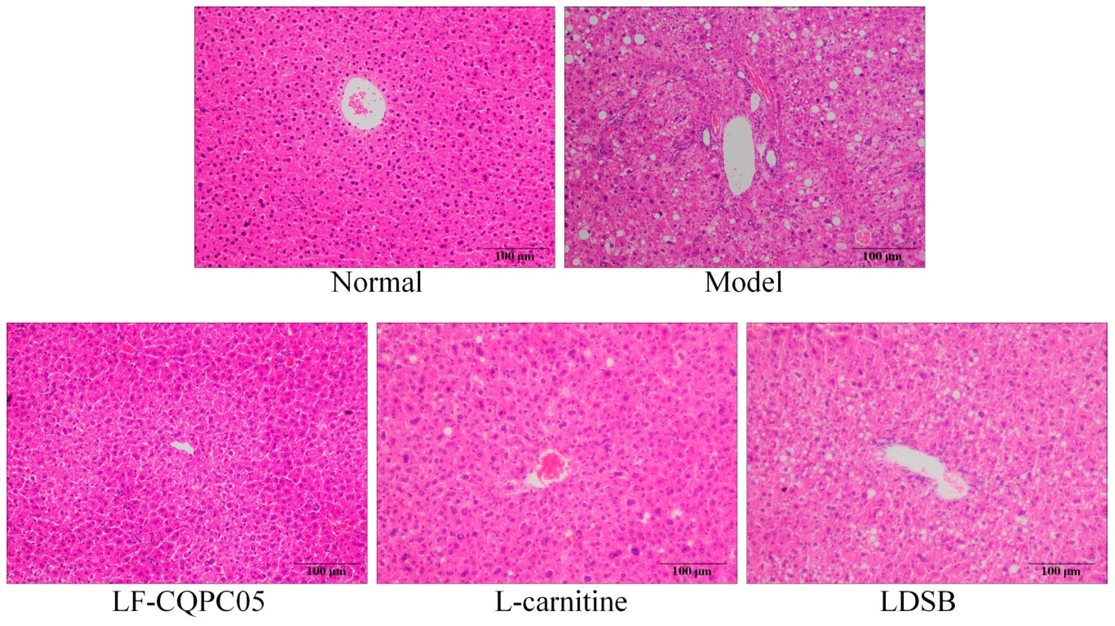 Microorganisms Free Full Text Anti Obesity Effects Of Lactobacillus Fermentum Cqpc05 Isolated From Sichuan Pickle In High Fat Diet Induced Obese Mice Through Ppar A Signaling Pathway Html