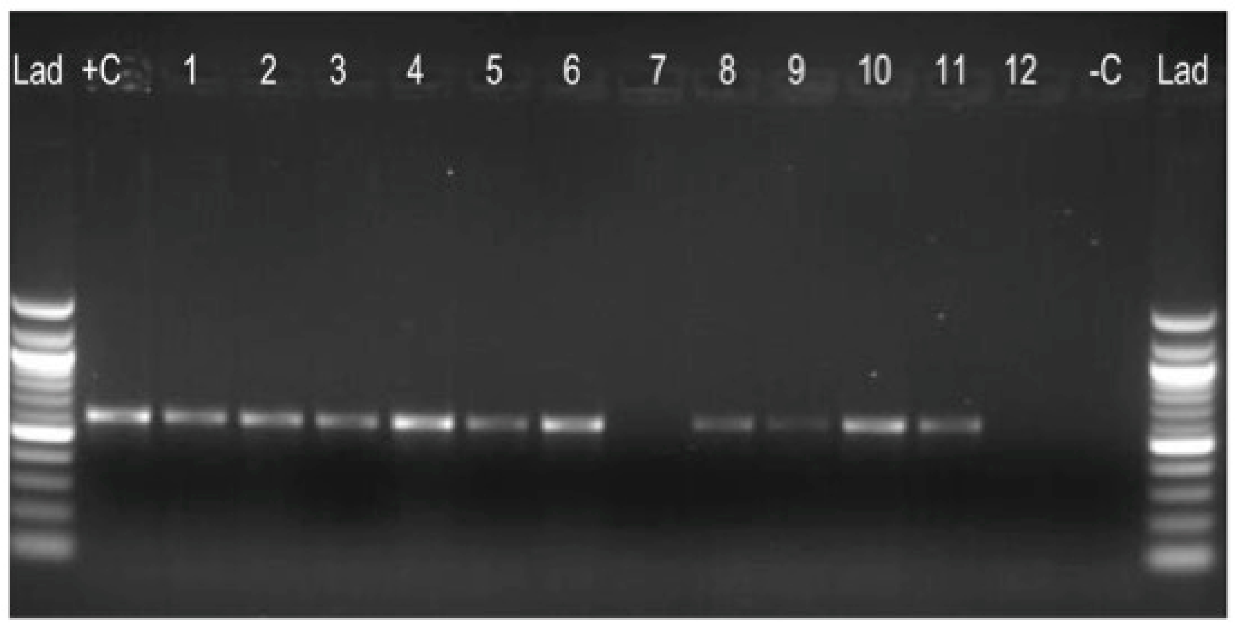 super strain of tuberculosis super strain of tuberculosis