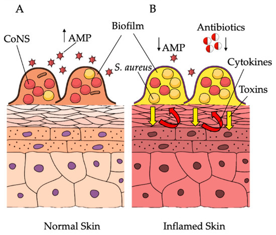 Probiotic markedly reduces S. aureus colonization in Phase 2 trial