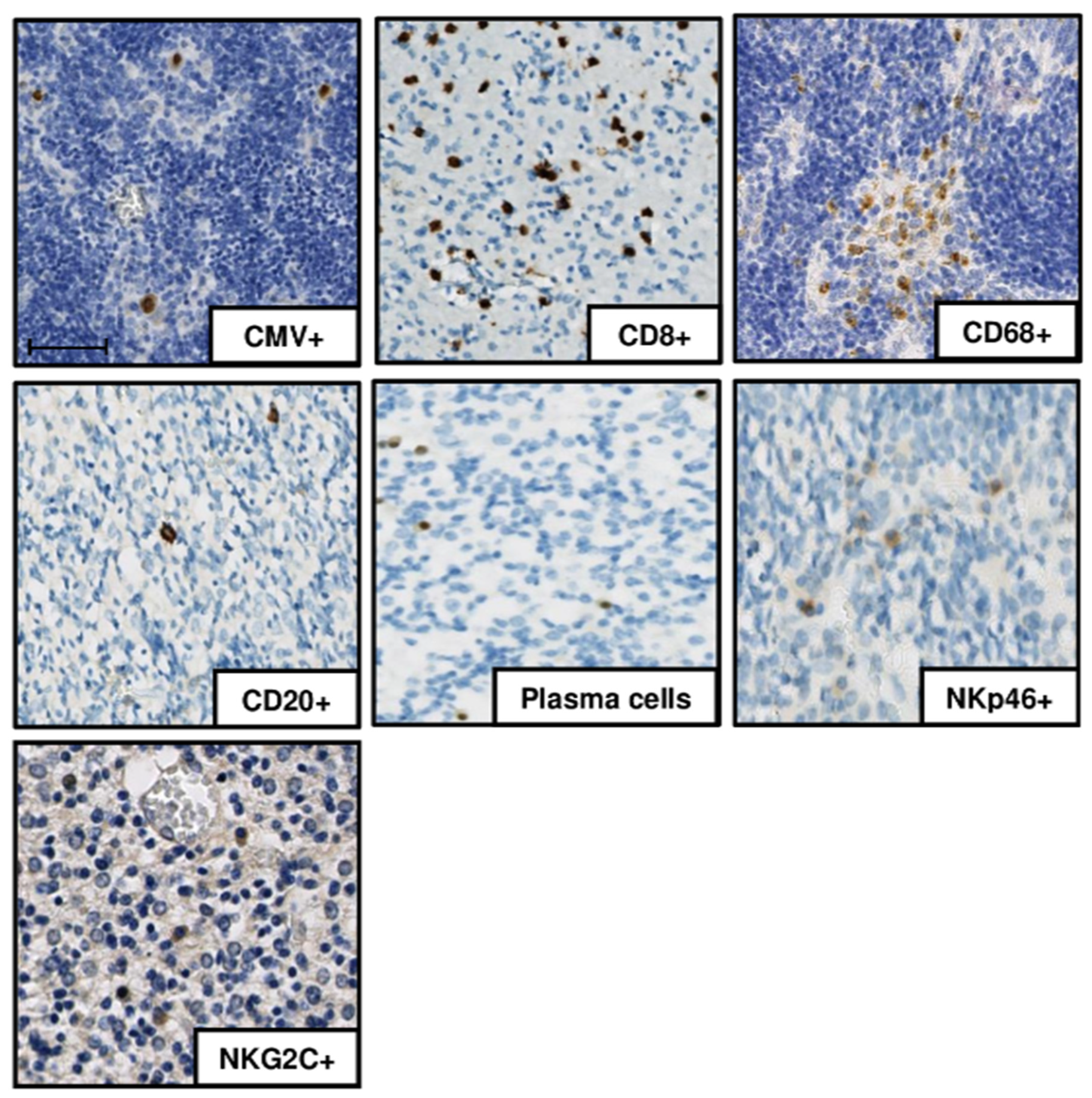 Microorganisms 08 00176 g001