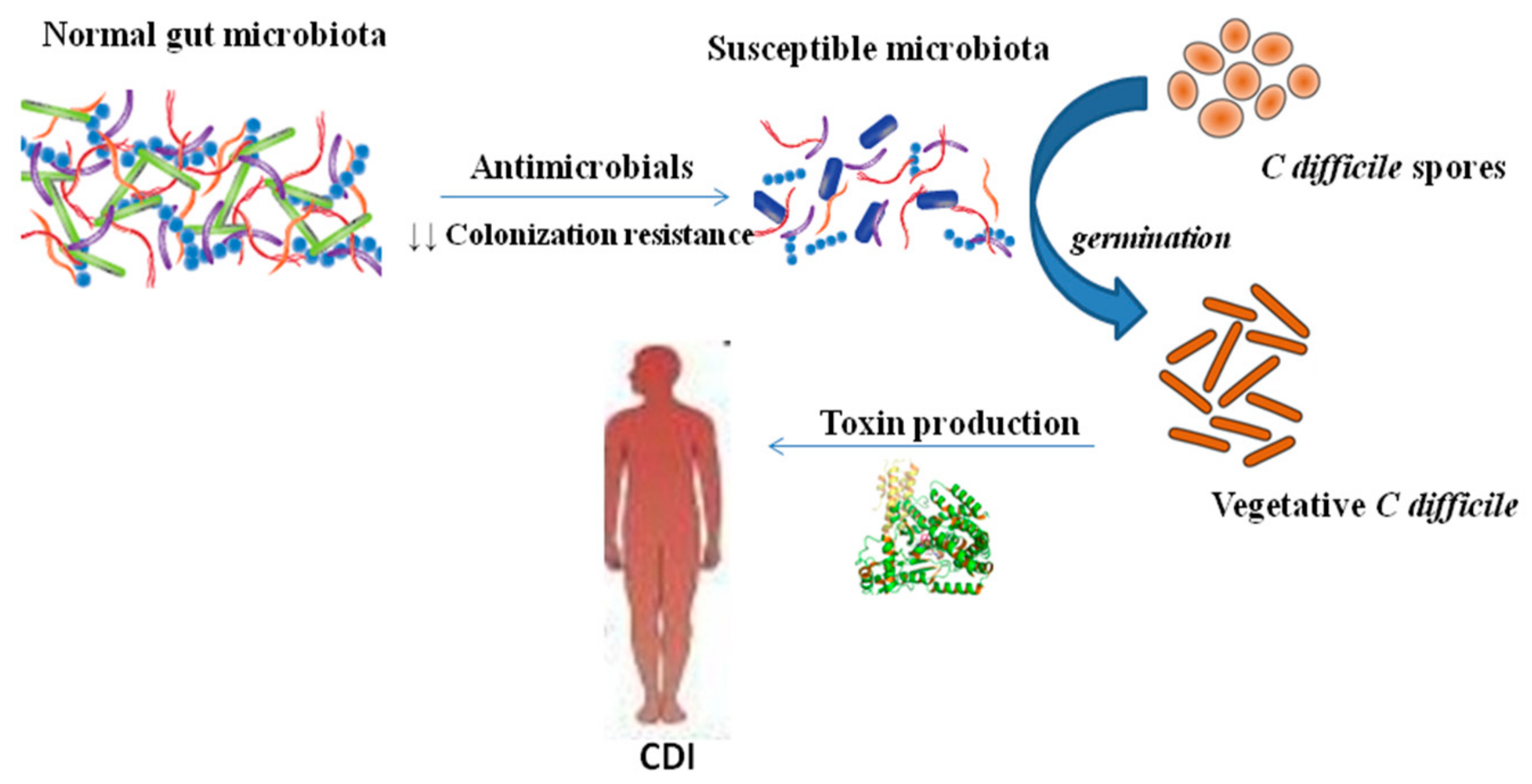 C. diff: What It Is, Symptoms, How It's Spread & Treatment