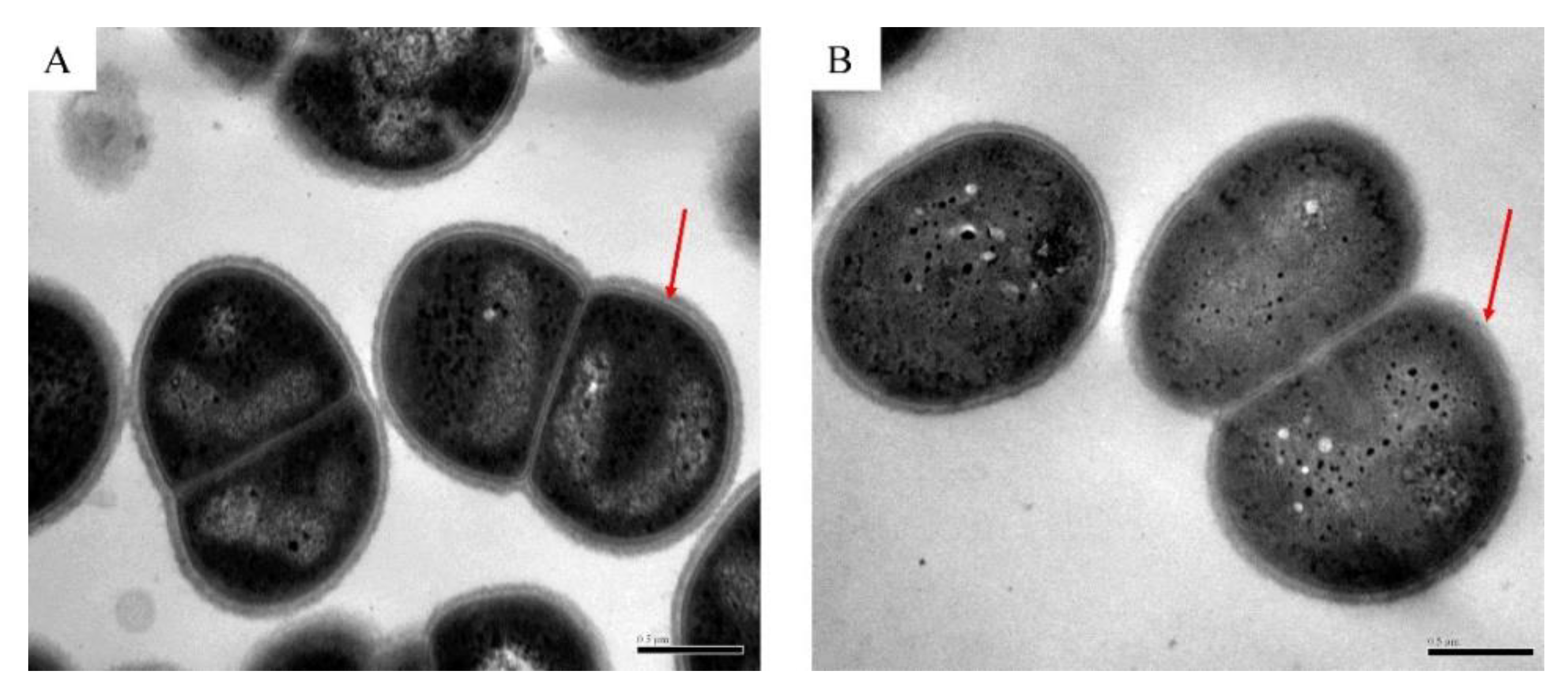 Deinococcus radiodurans