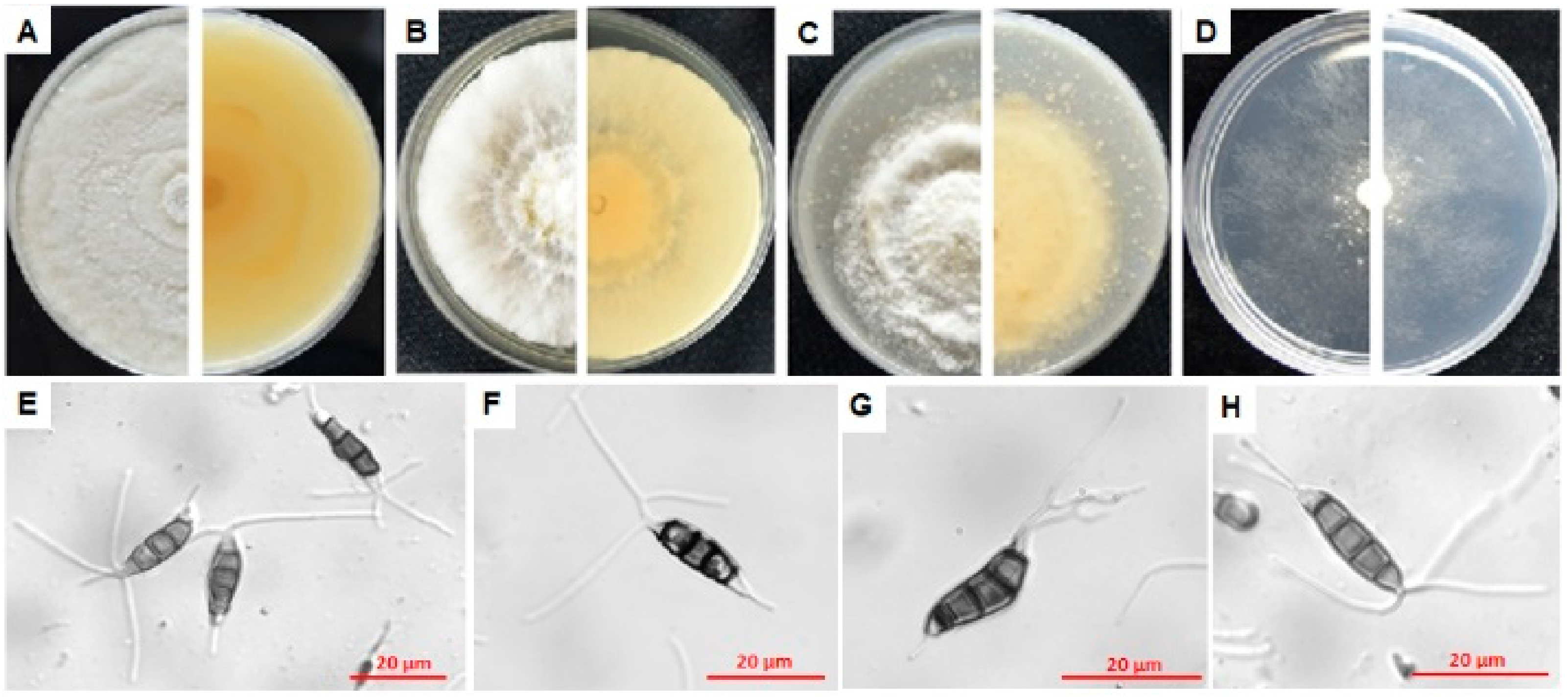 Microorganisms 08 00689 g008 Microorganisms 08 00689 g008