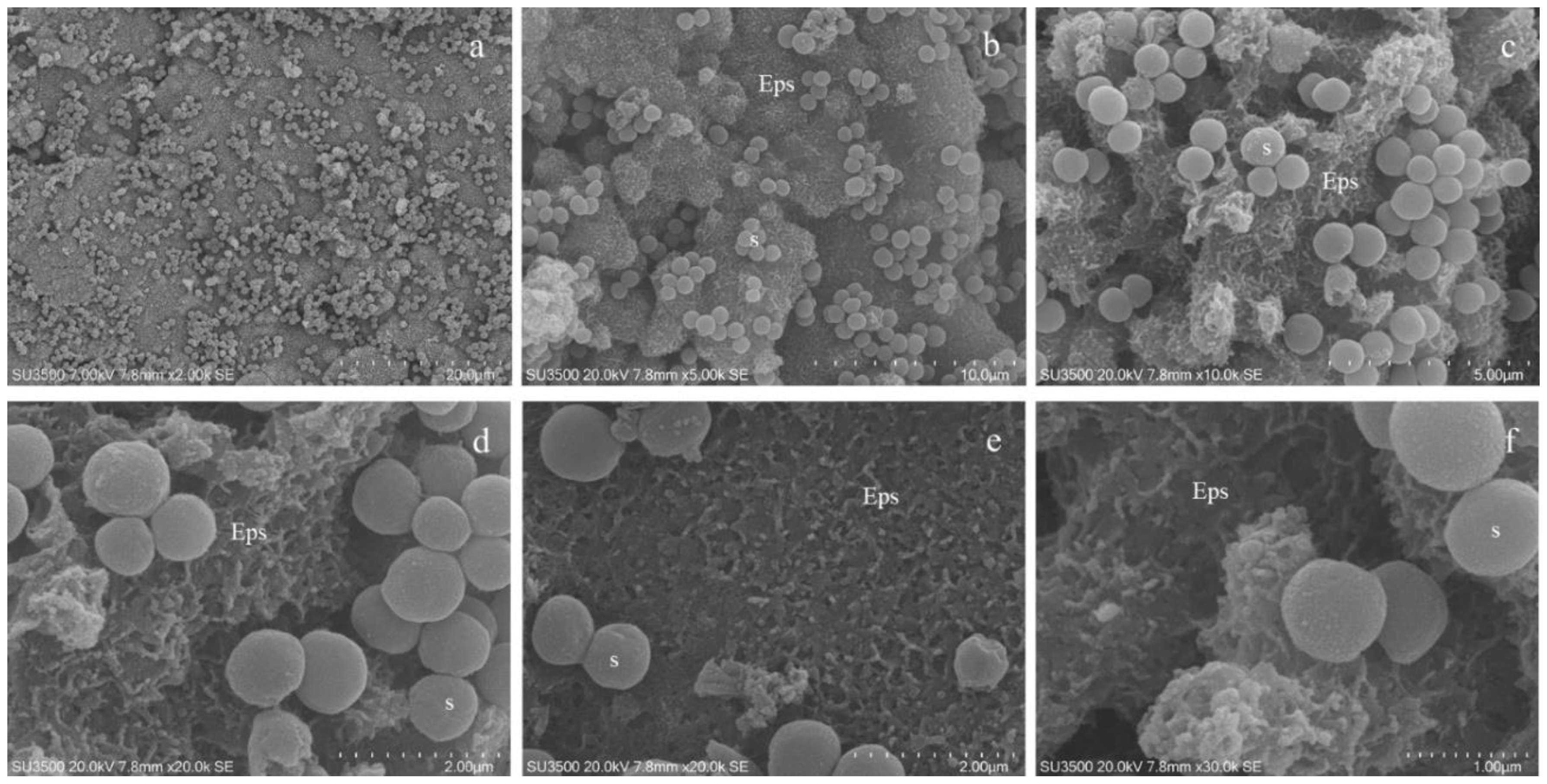 Microorganisms Free Full Text Characterization Of Scardovia Wiggsiae Biofilm By Original Scanning Electron Microscopy Protocol Html Microorganisms Free Full Text Characterization Of Scardovia Wiggsiae Biofilm By Original Scanning Electron Microscopy Protocol Html