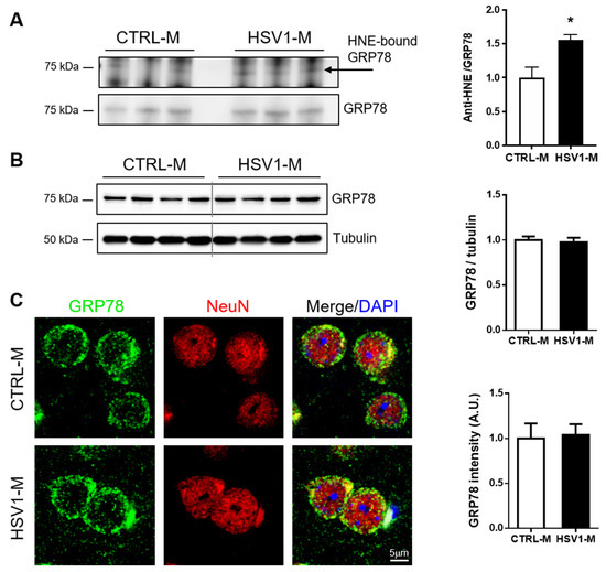 Herpes Simplex Virus-1 in the Brain: The Dark Side of a Sneaky Infection:  Trends in Microbiology