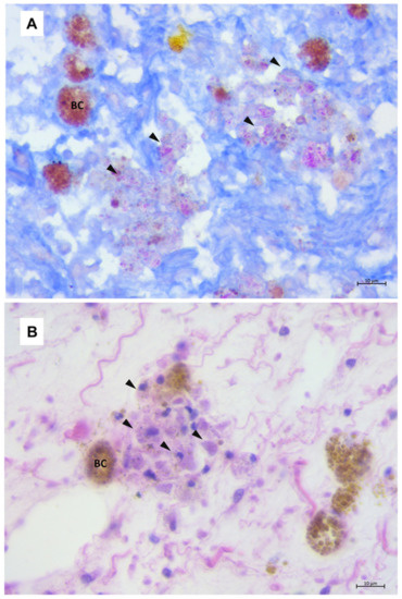 Mycobacteriosis in Aquatic Invertebrates: A Review of Its Emergence