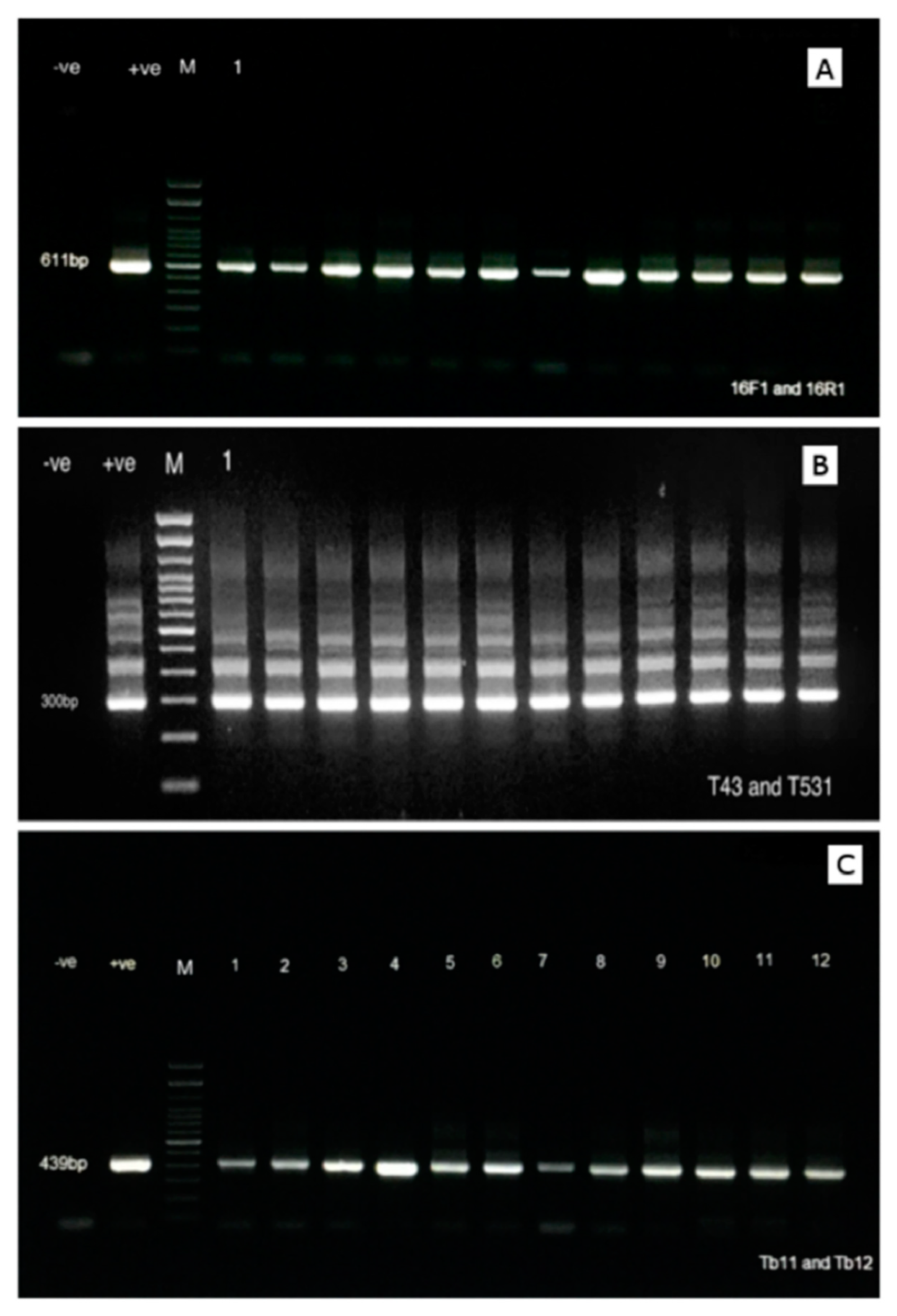 Microorganisms Free Full Text Identification Mycobacterium Spp In The Natural Water Of Two Austrian Rivers Html