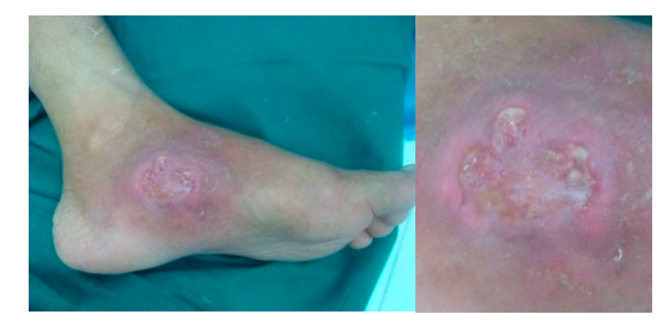 Microorganisms 08 01312 g004 Microorganisms 08 01312 g004