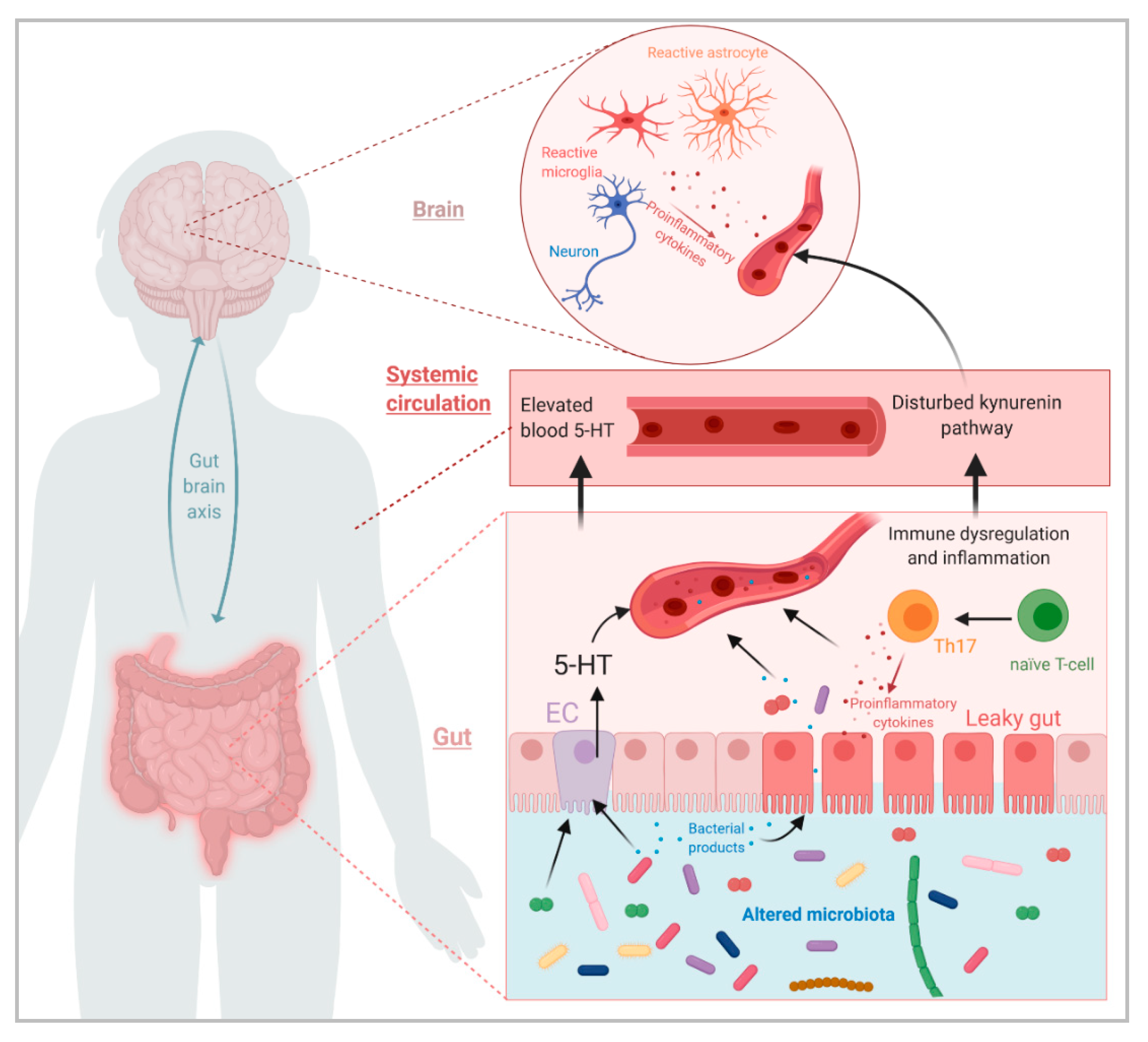 ASD, Digestive Issues and Pica, Autism, NCBDDD