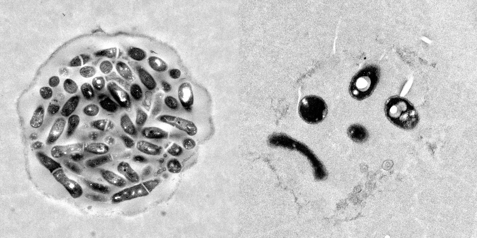 Microorganisms Free Full Text Evidence That Bacteria Packaging By Tetrahymena Is A Widespread Phenomenon Html