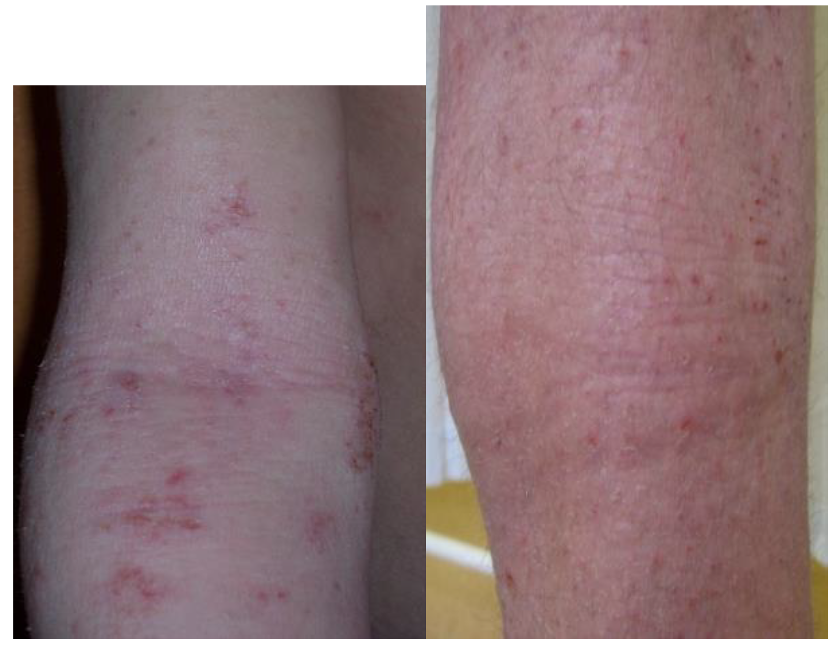 Microorganisms 08 01743 g002 Microorganisms 08 01743 g002