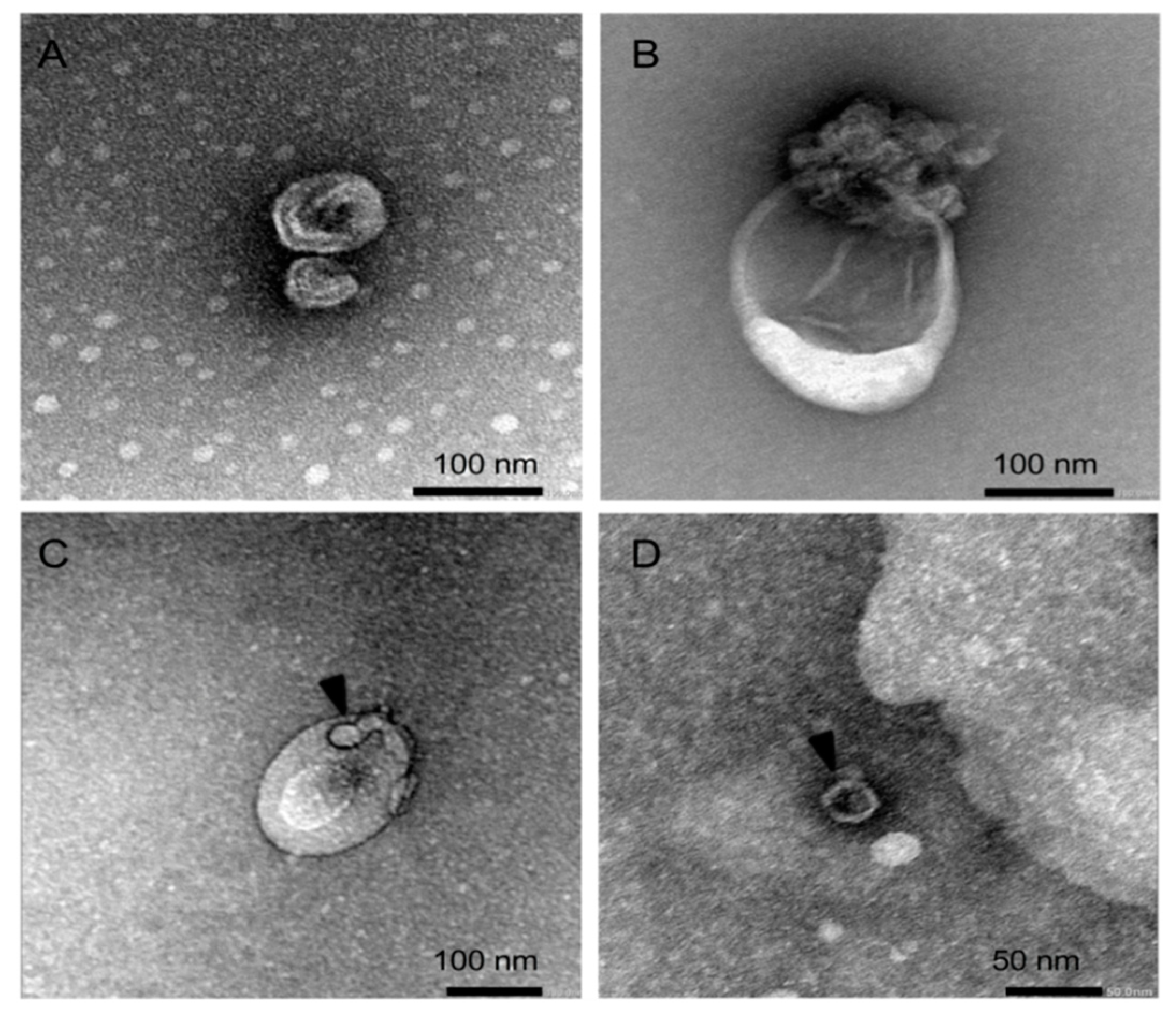 Microorganisms 08 01753 g002