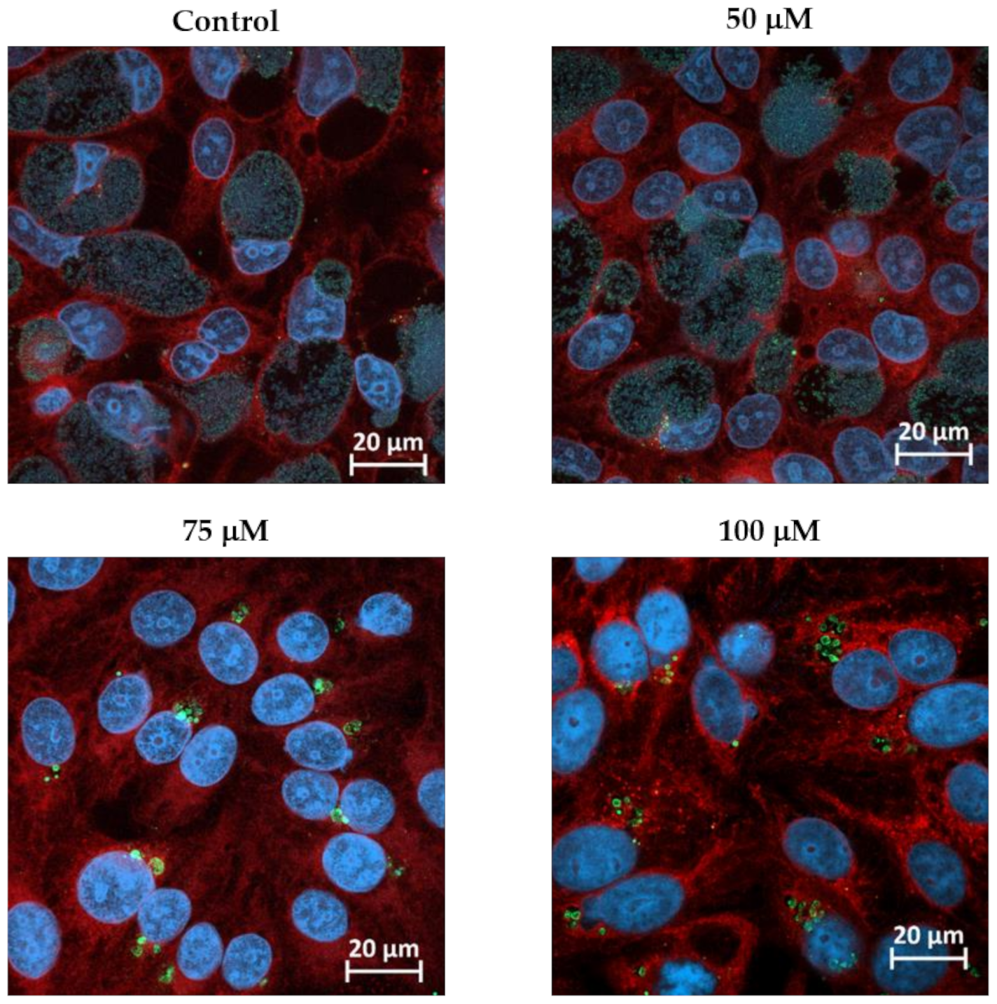 Microorganisms 08 01848 g001