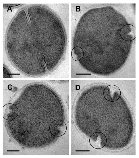 Staphylococcus aureus Bacteria, Scanning electron micrograp…