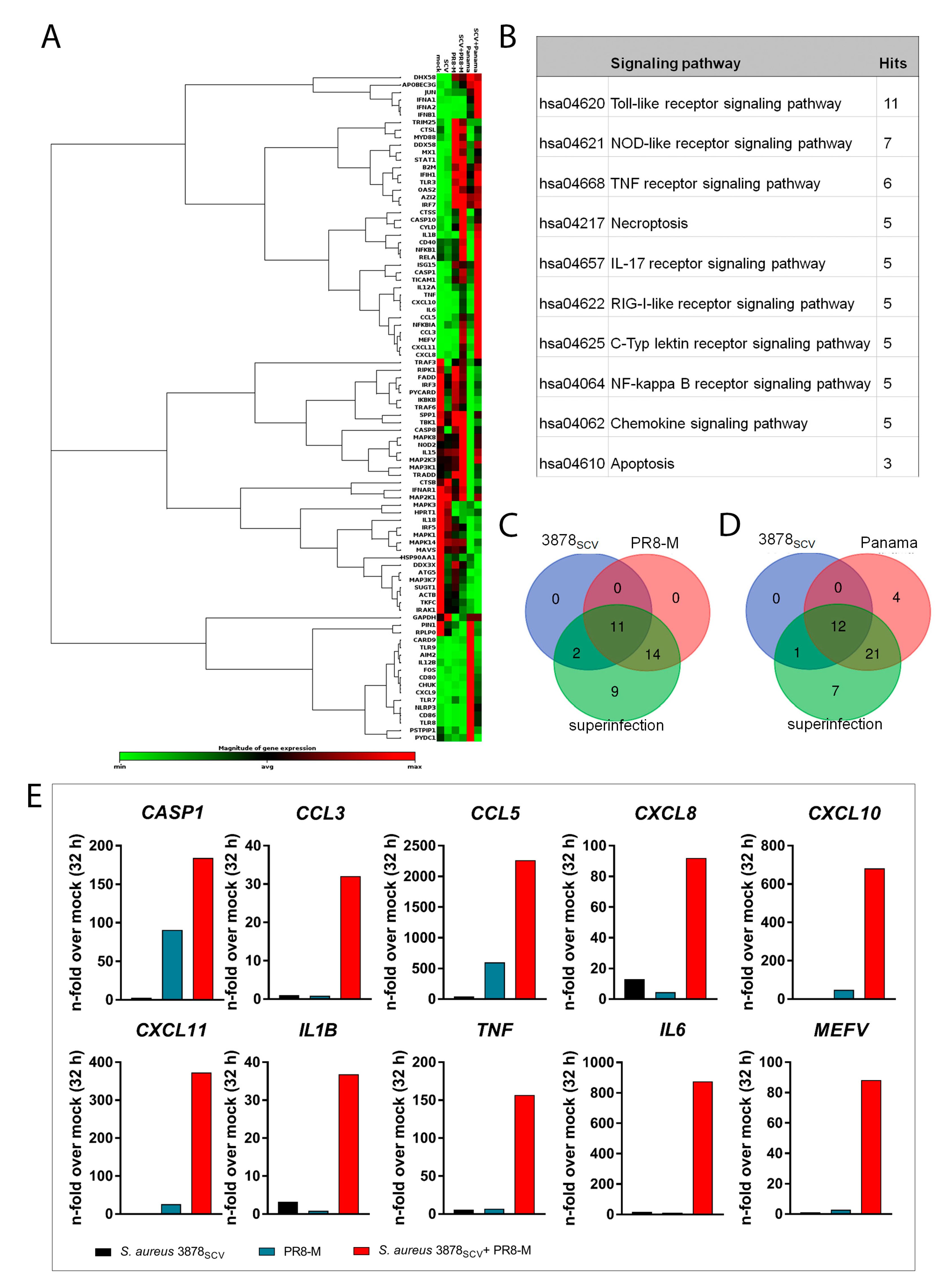 Interaction of Staphylococcus aureus and Host Cells upon Infection of  Bronchial Epithelium during Different Stages of Regeneration