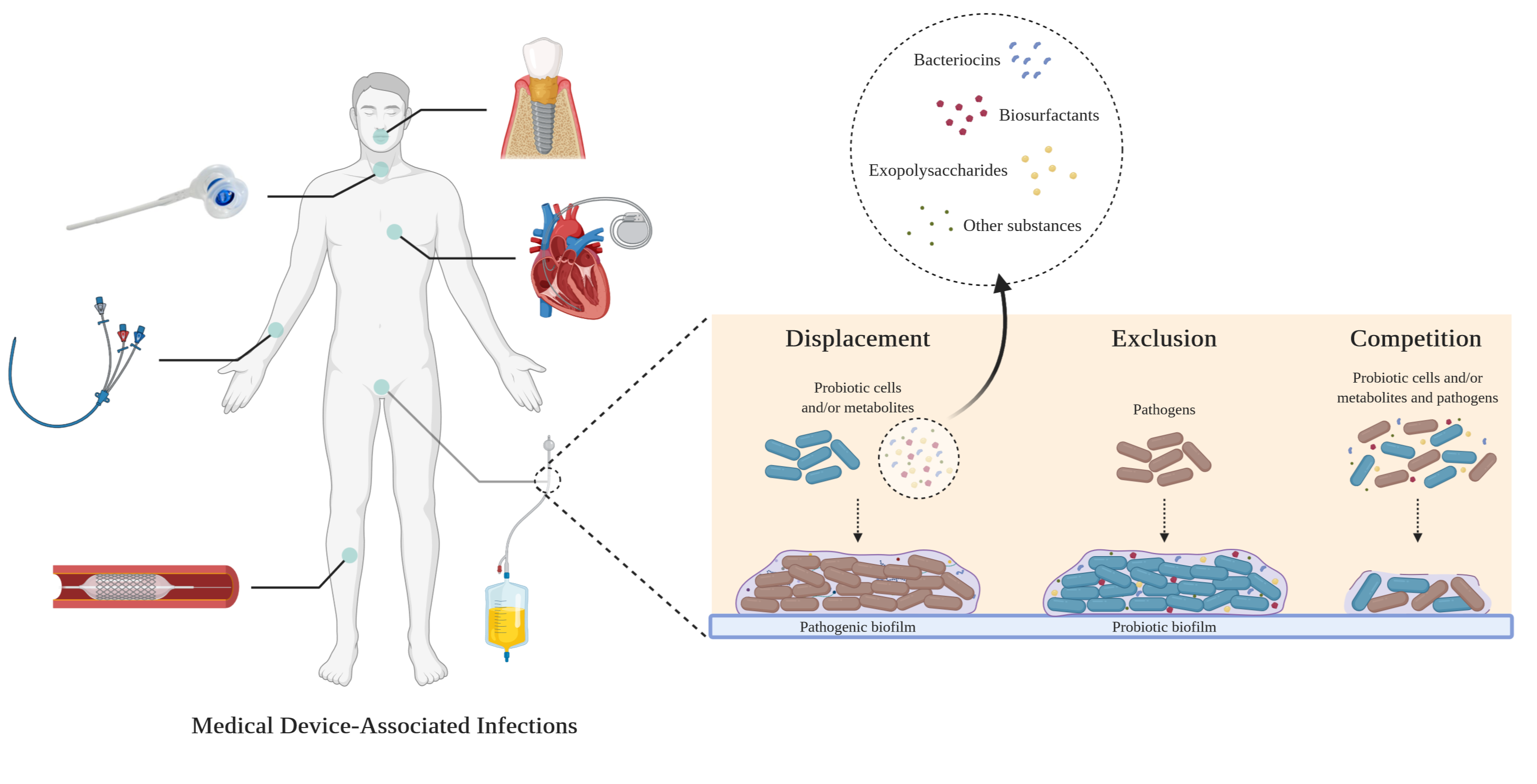 Microorganisms | Free Full-Text | The Use of Probiotics to Fight ...