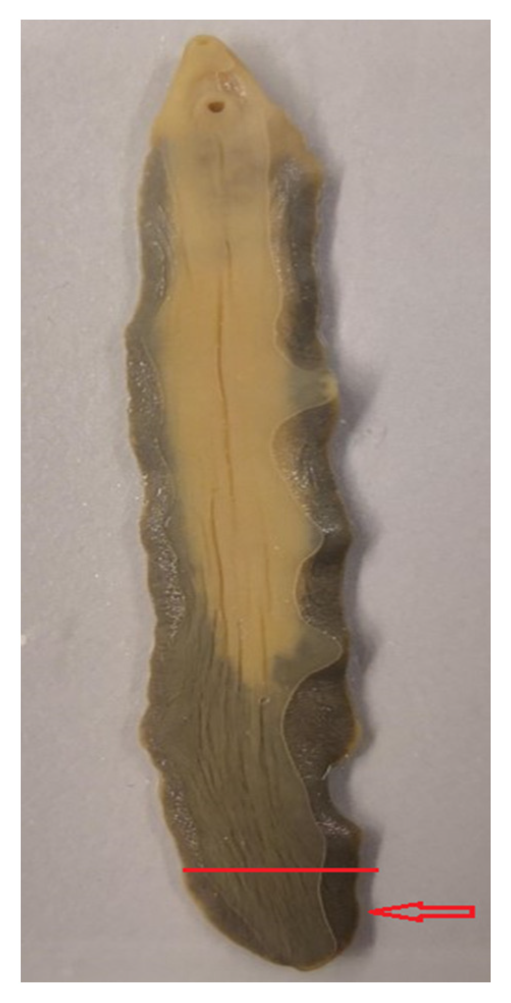 fascioliasis mi ez)