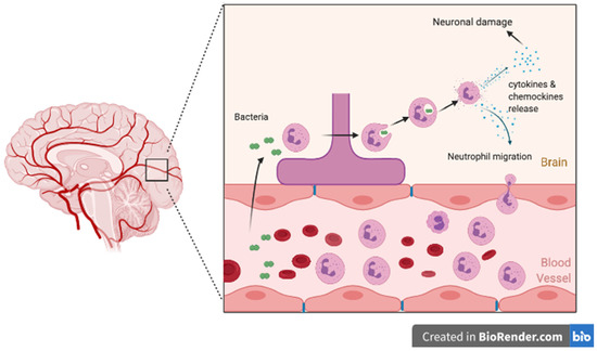 Microorganisms | Free Full-Text | Bacterial Meningitis In Children:  Neurological Complications, Associated Risk Factors, And Prevention | Html
